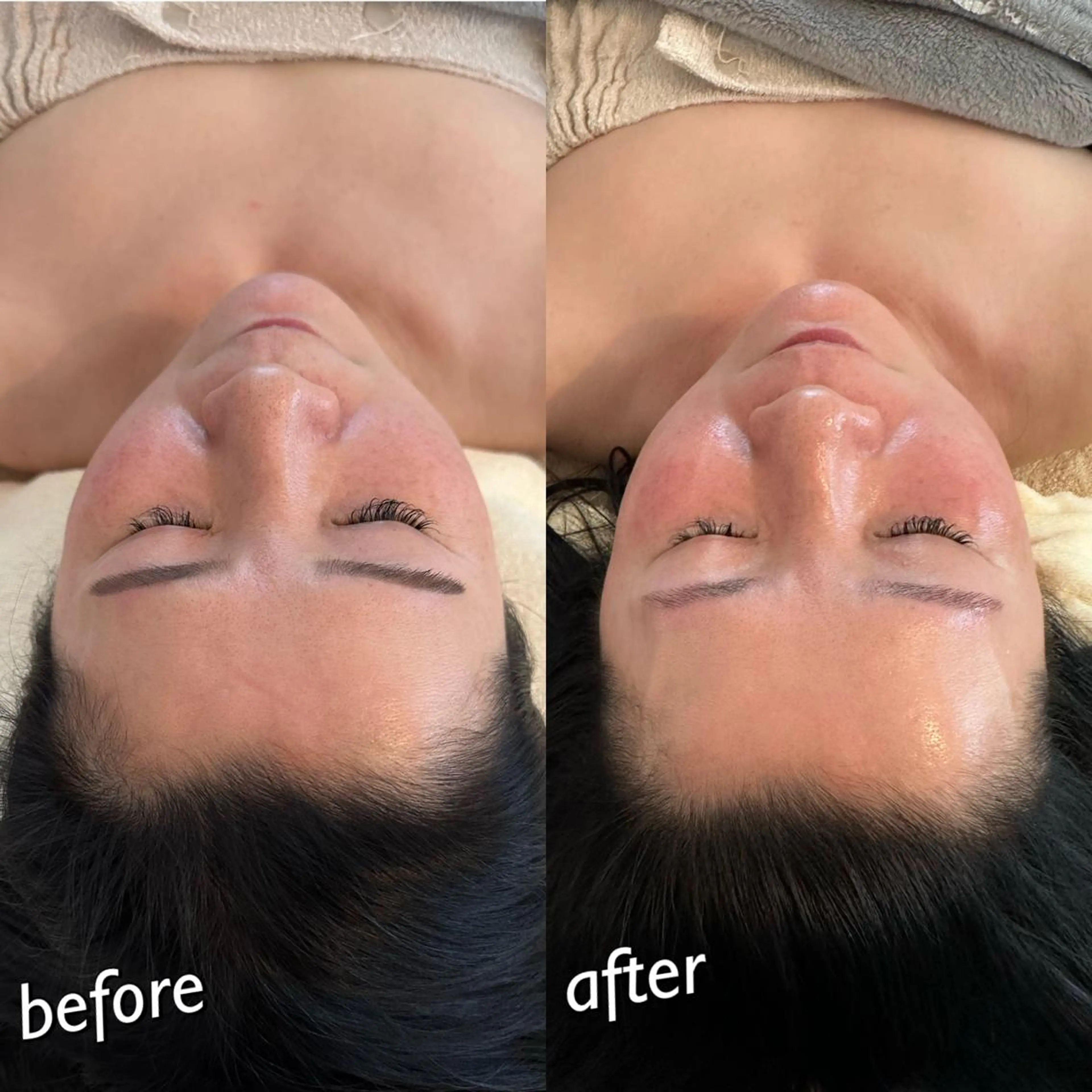 うなじ脱毛/美肌脱毛 LABELのエステ・リラクイメージ