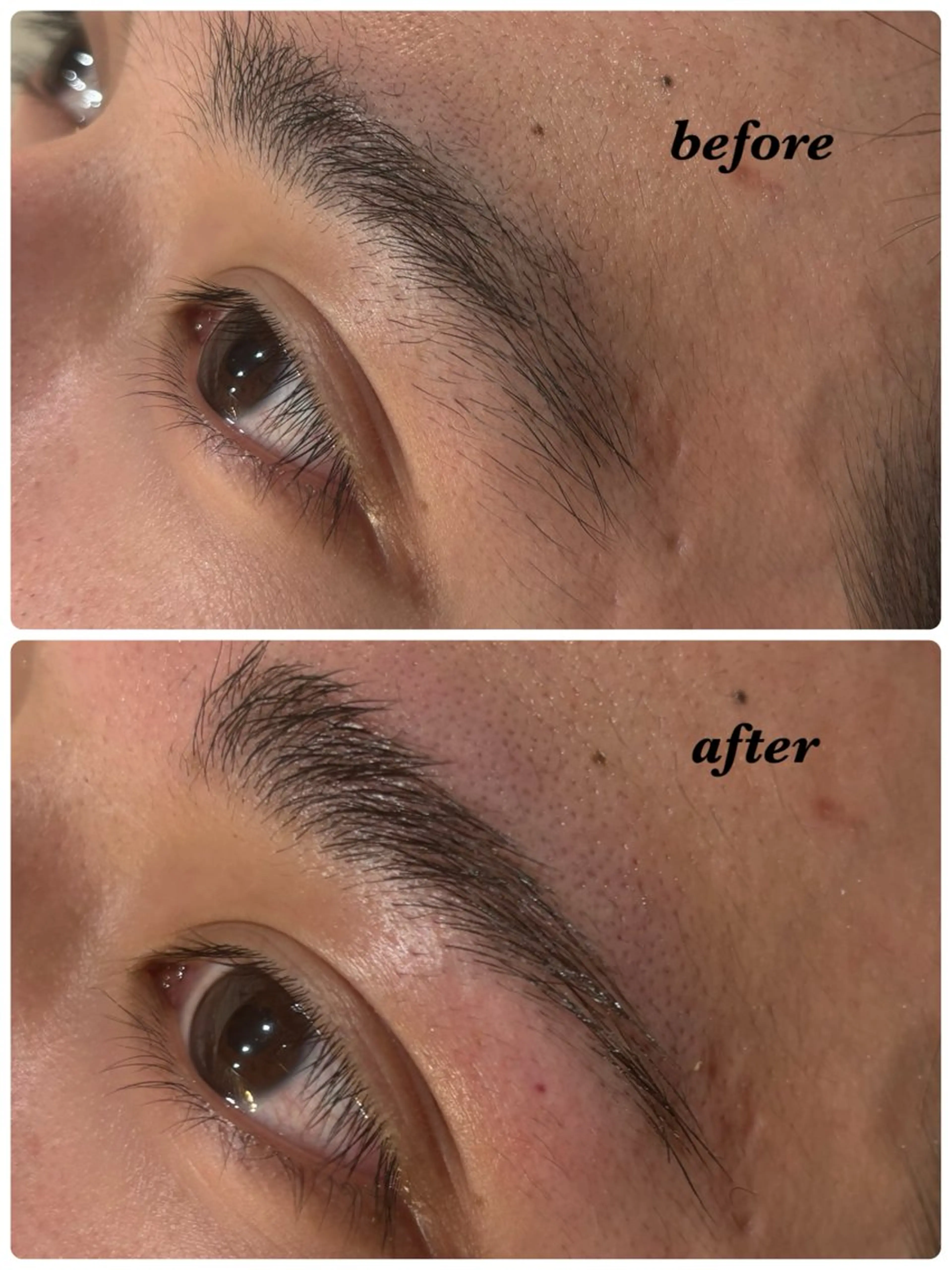 メンズ アイブロウ ハーブピーリング/韓国肌管理/フェイシャル/毛穴洗浄/眉毛/顔脱毛【糸脱毛専門】rev所属・ハーブピーリング🌹 毛穴洗浄❤️眉waxのエステ・リラクイメージ