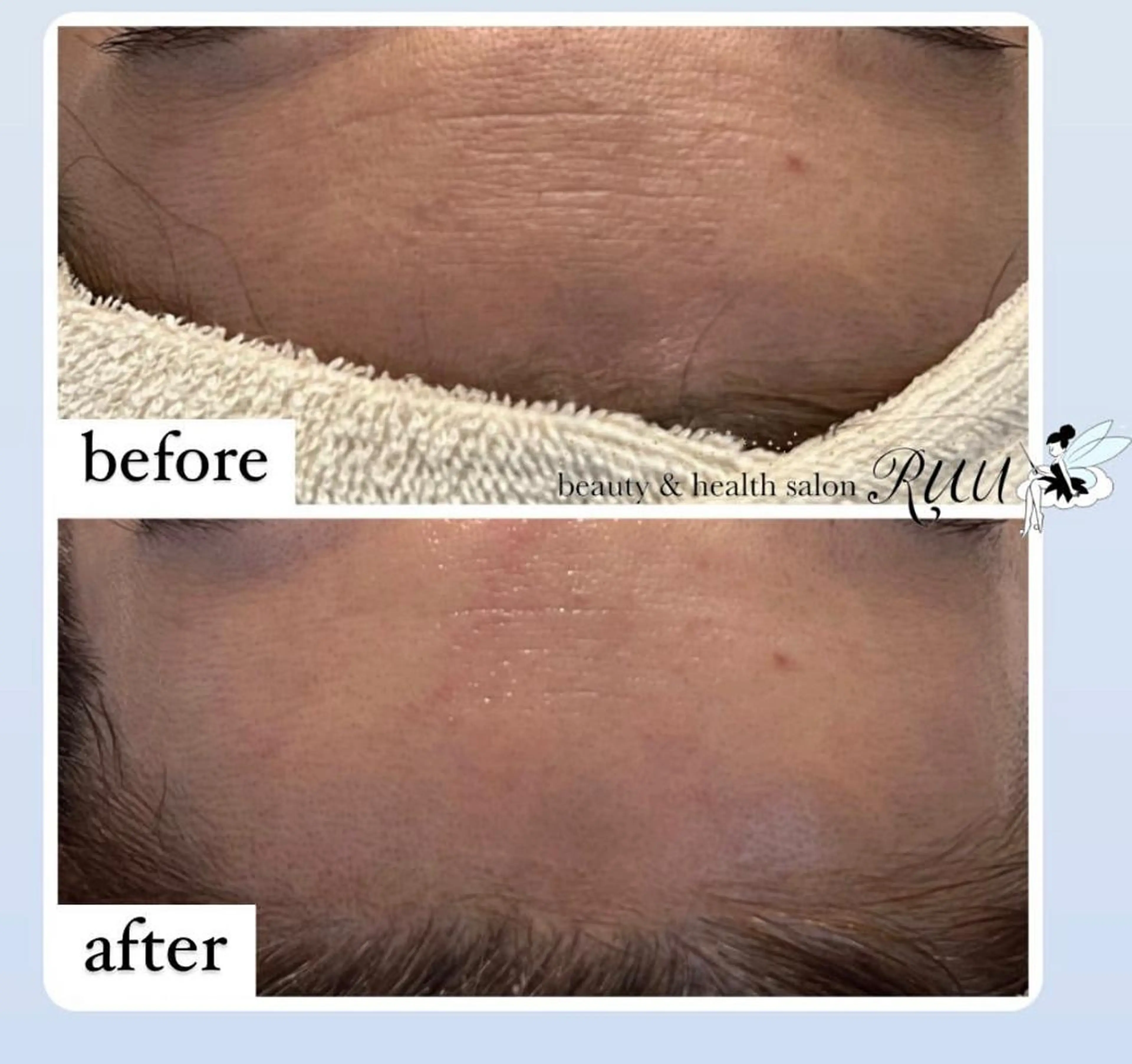 【頭痛、睡眠改善】 salon RUUのエステ・リラクイメージ