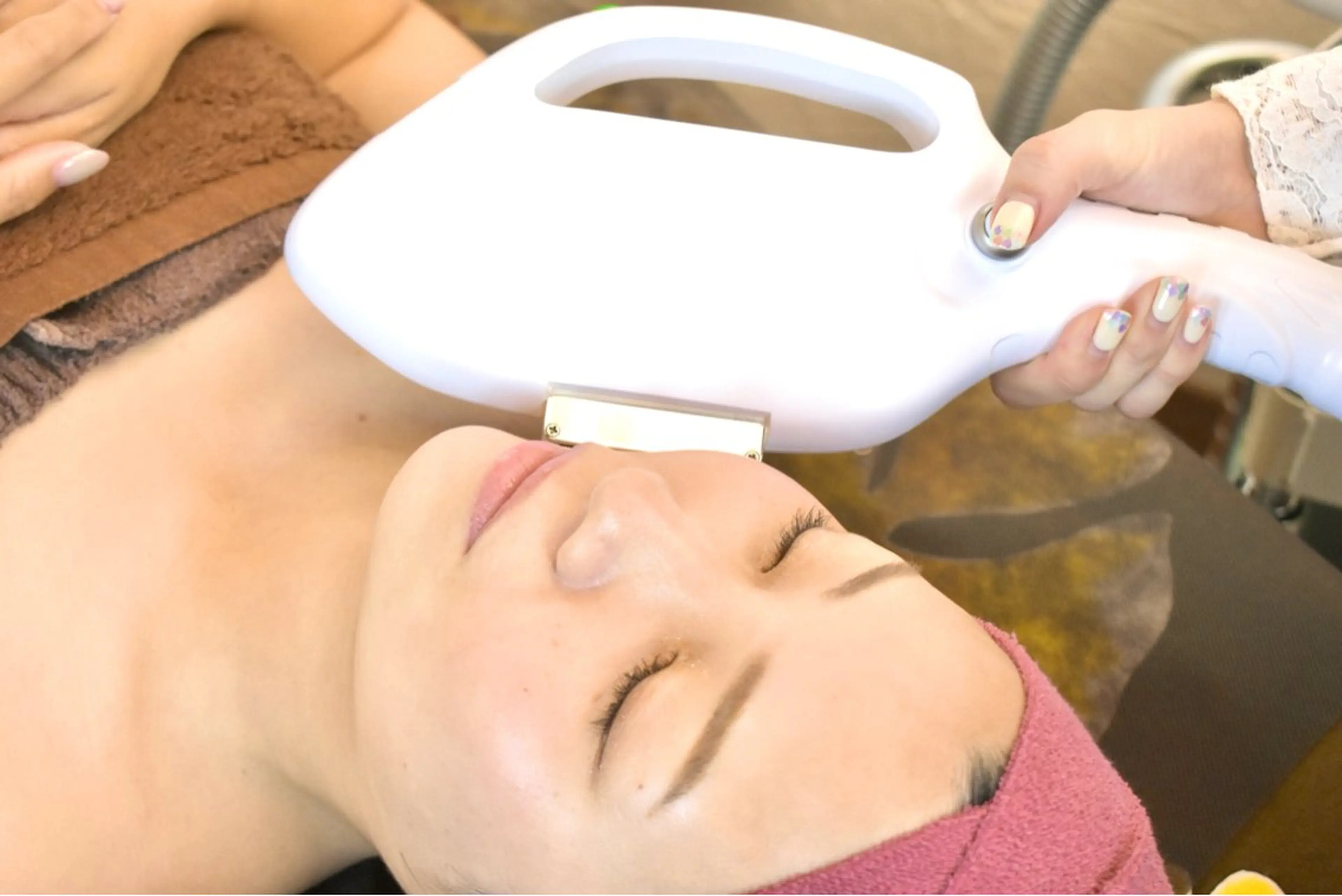 ladies顔脱毛の写真