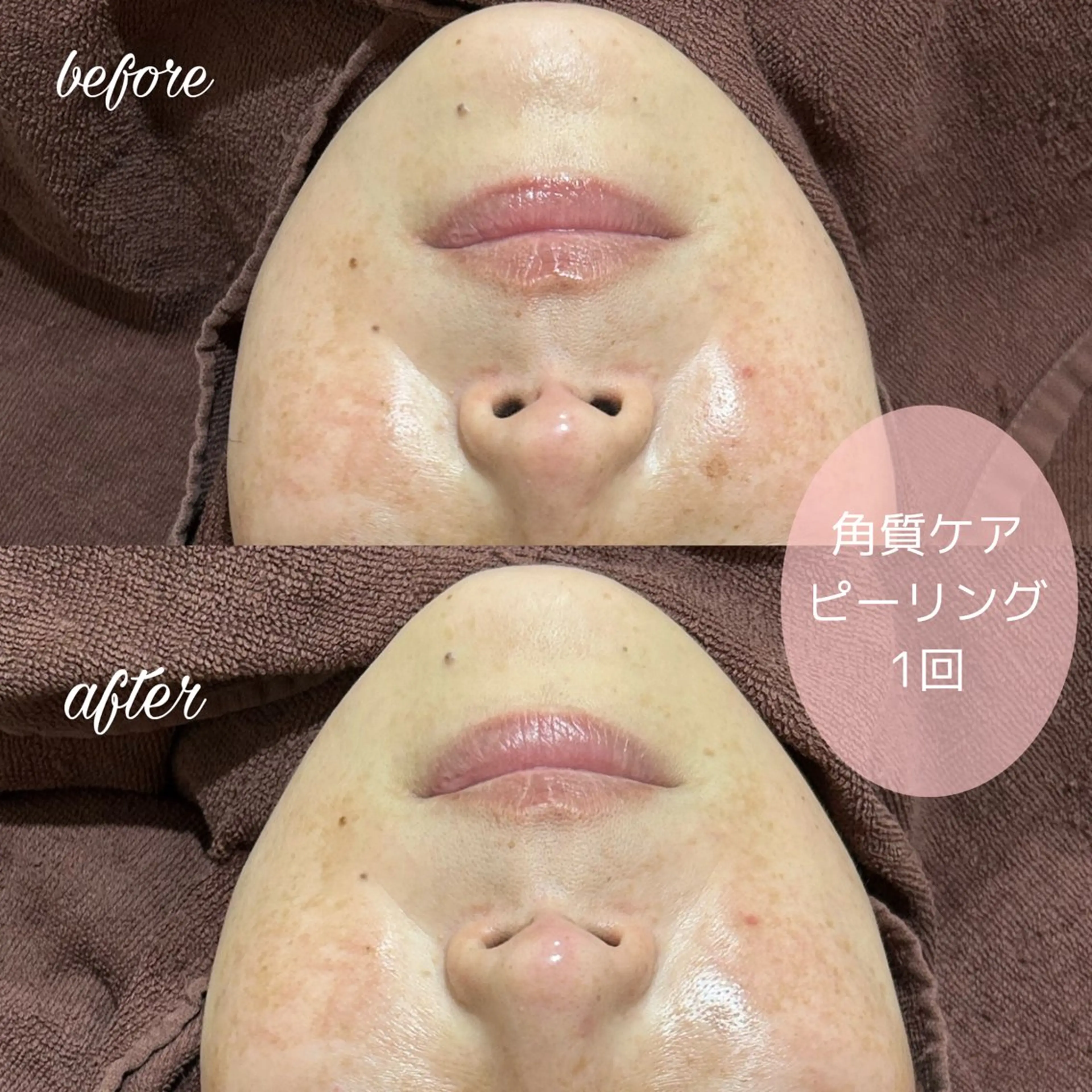 merveilles所属・まつげ/整体/にきび ・アトピー専門サロンのマツエク・マツパデザイン