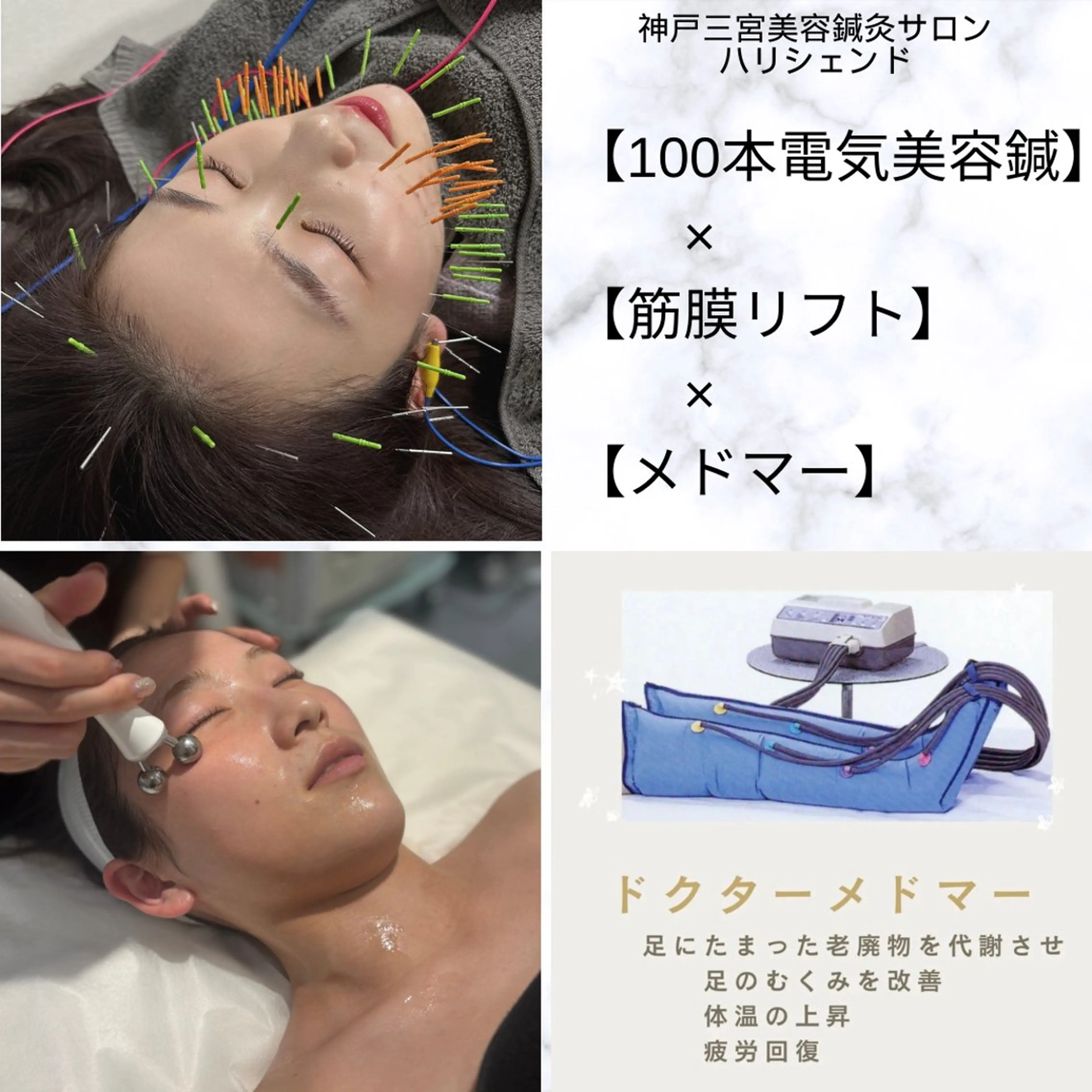 人気No,1！鍼100本使用！リフトアップ、エラ改善【鍼100本】×【電気】×【小顔筋膜リフト】約90分の写真