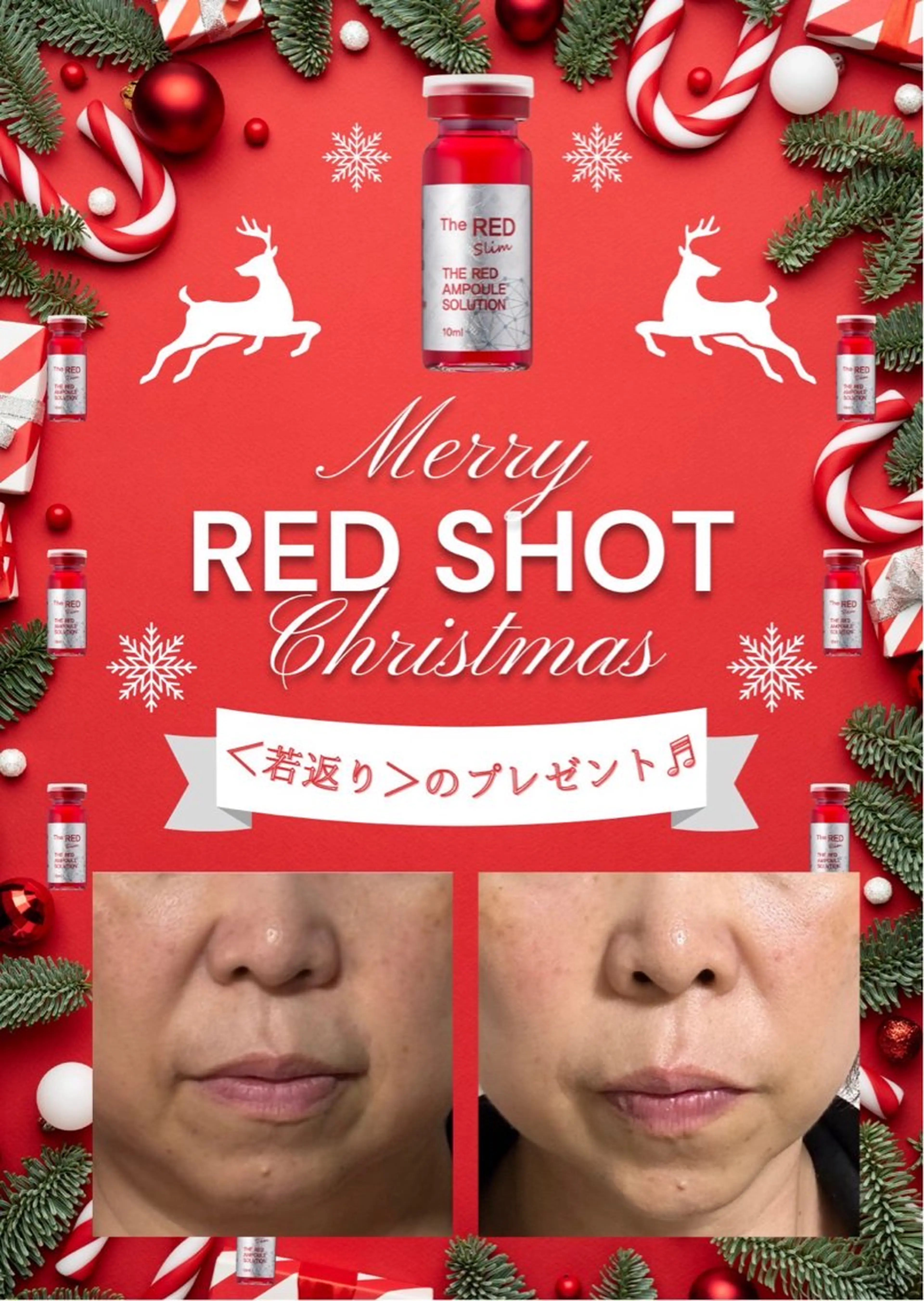 刺さずに脂肪を落とすREDSHOTの写真
