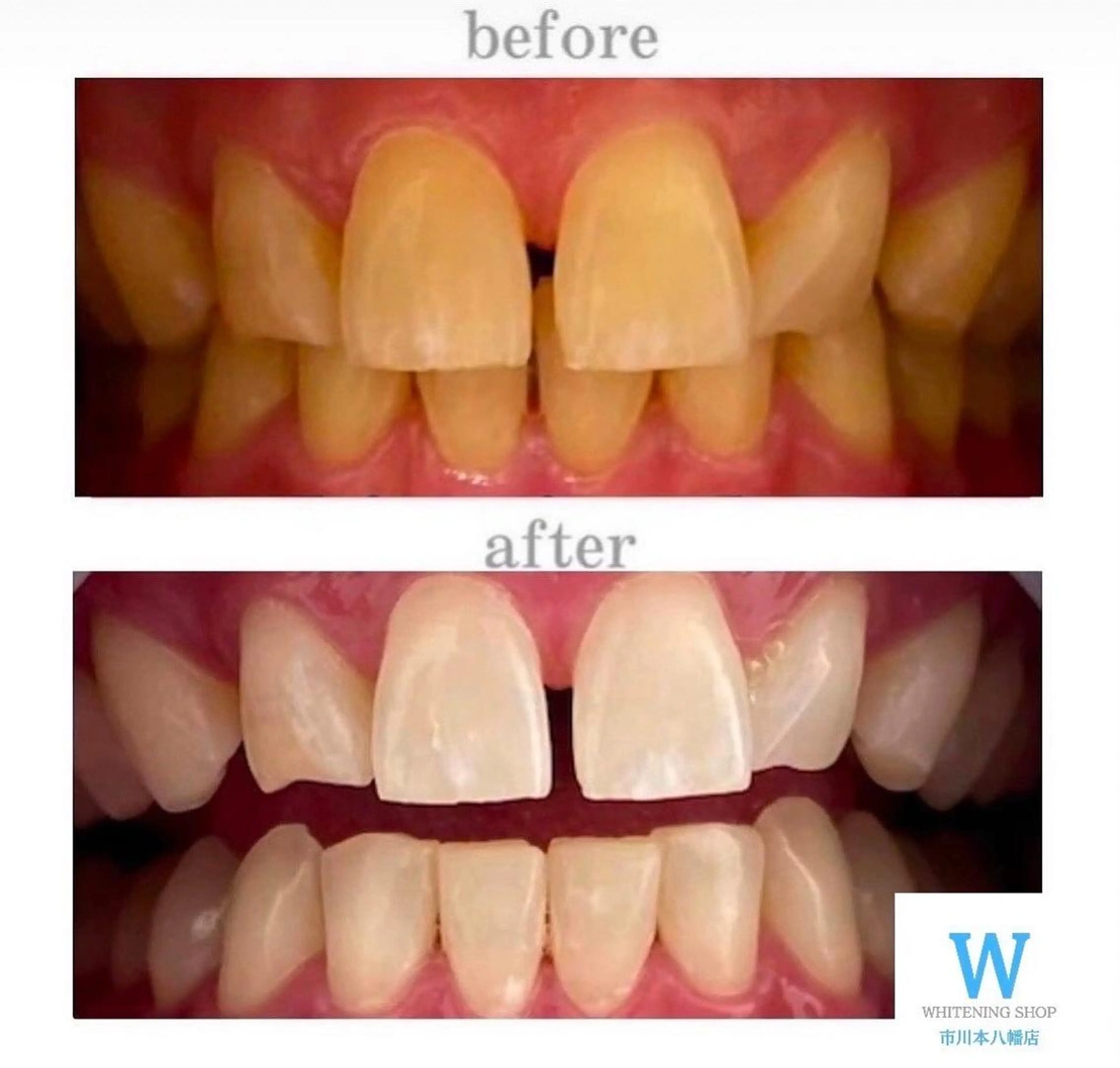 ホワイトニング ショップ本八幡店のエステ・リラクイメージ