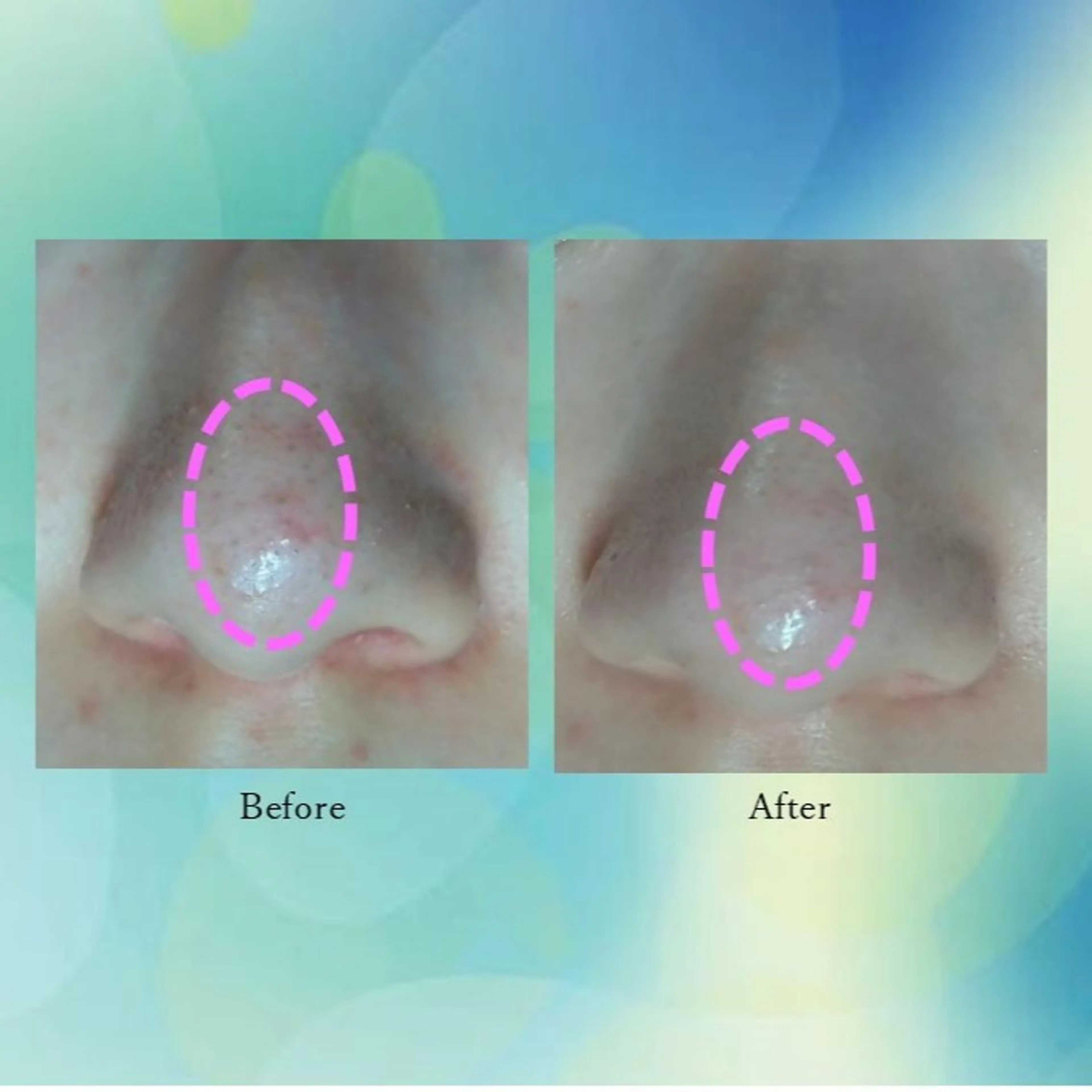 その他 ふじわら ひかりのその他イメージ