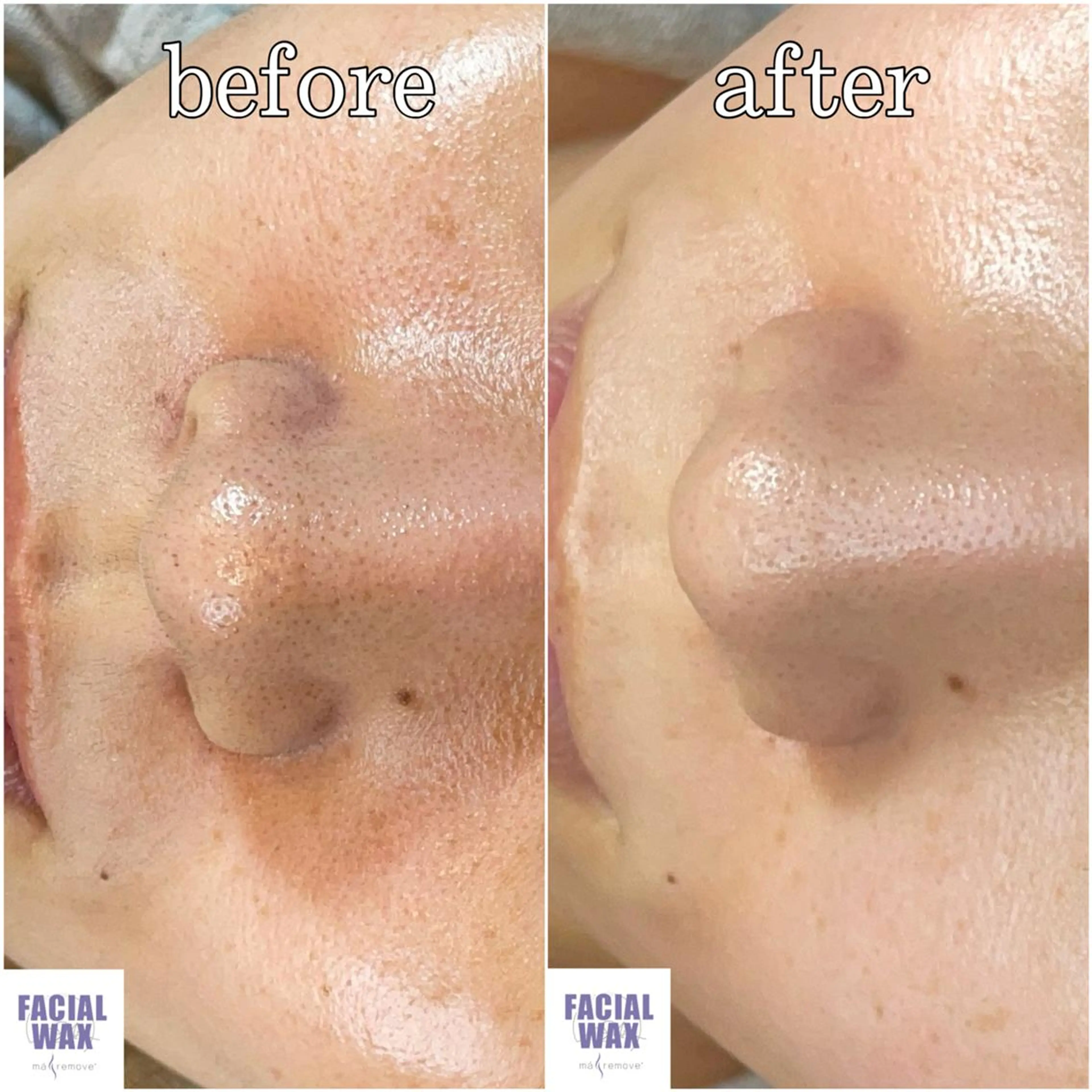 エステ MANA まつげ・眉毛の眉毛・アイブロウイメージ