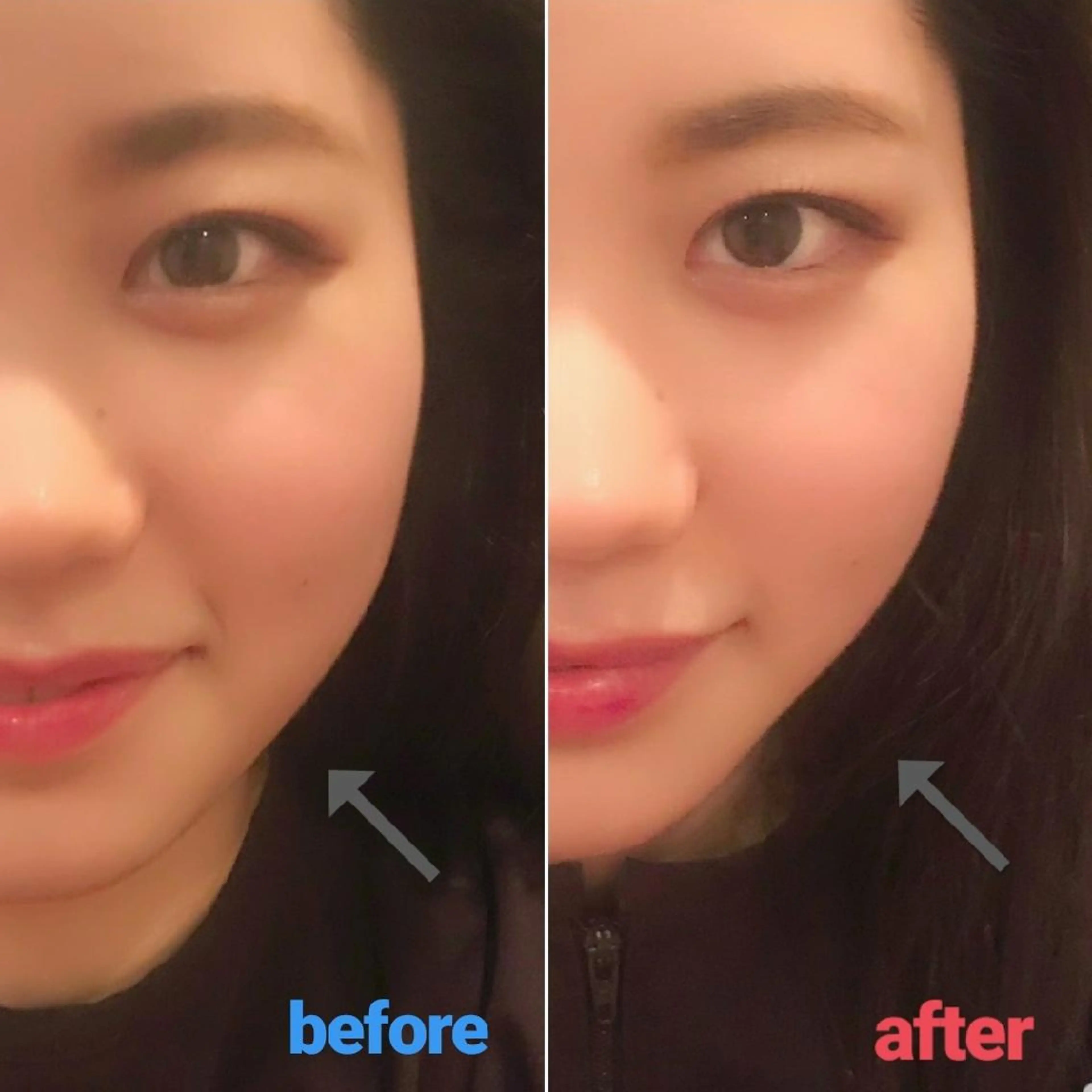 小顔美容鍼灸Acubelle Yakuin.【アキュベル薬院】所属・石川 真梨奈  美容鍼灸/アロマのエステ・リラクイメージ