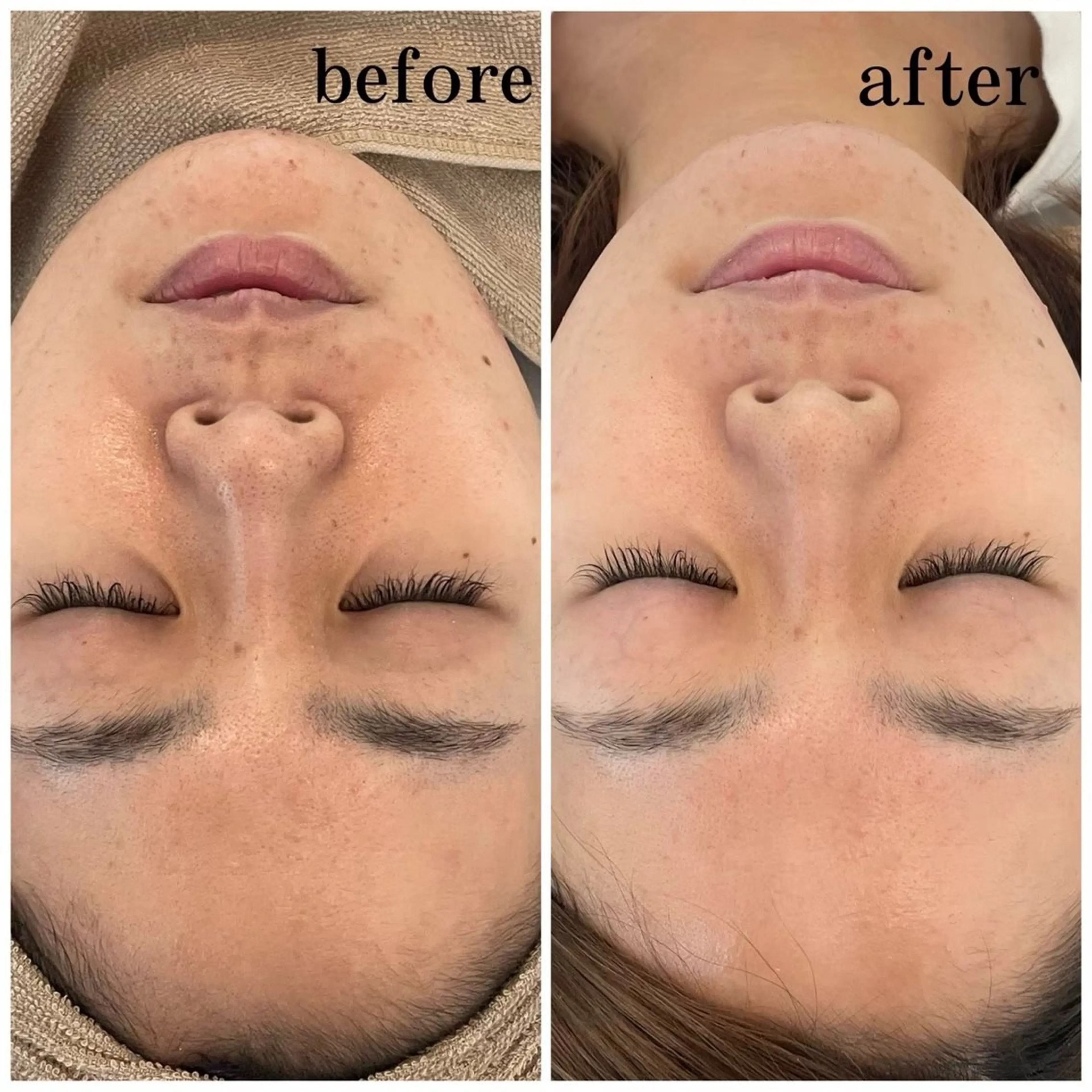 Belle所属・韓国肌管理 Belleのエステ・リラクイメージ