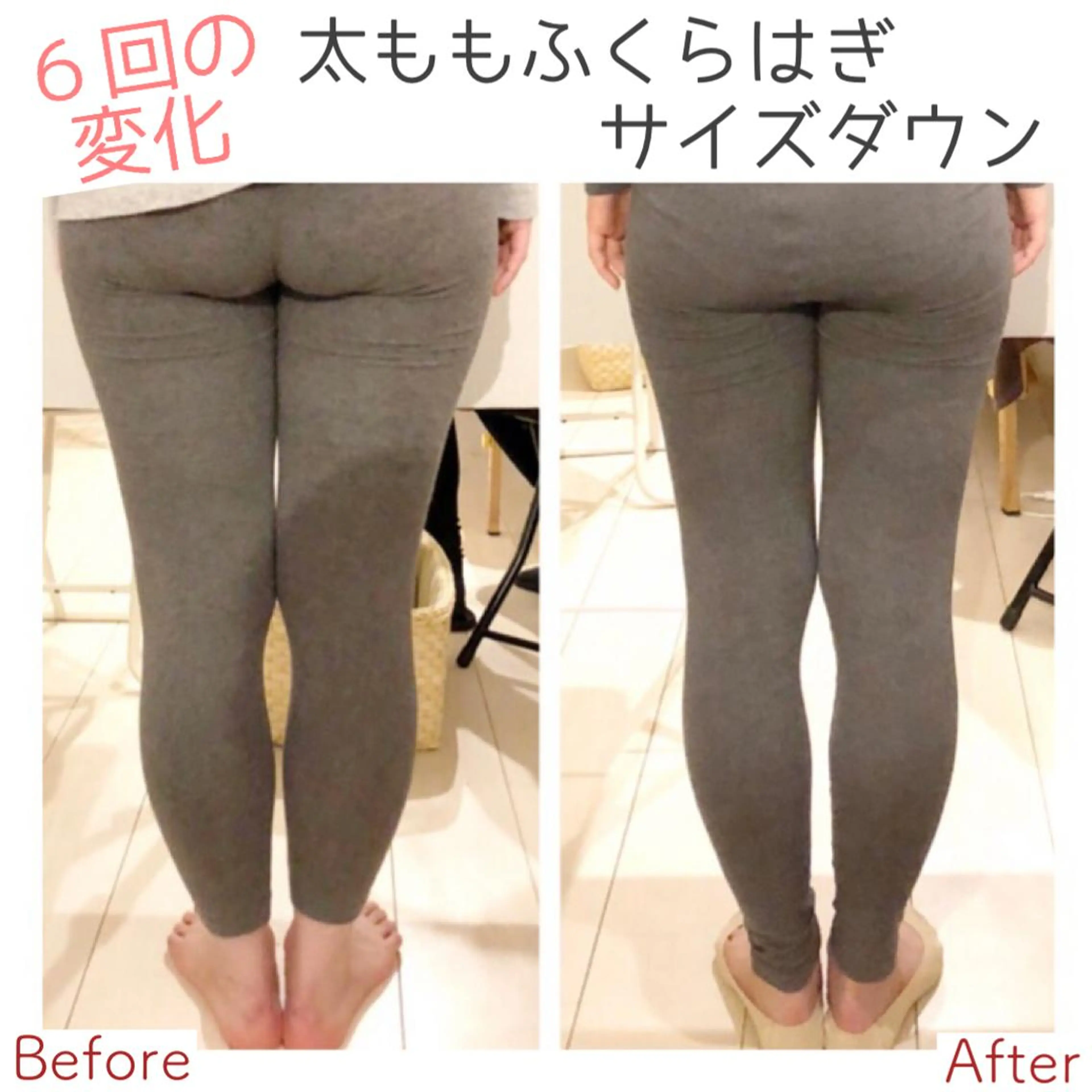 小顔モニター 募集のエステ・リラクイメージ