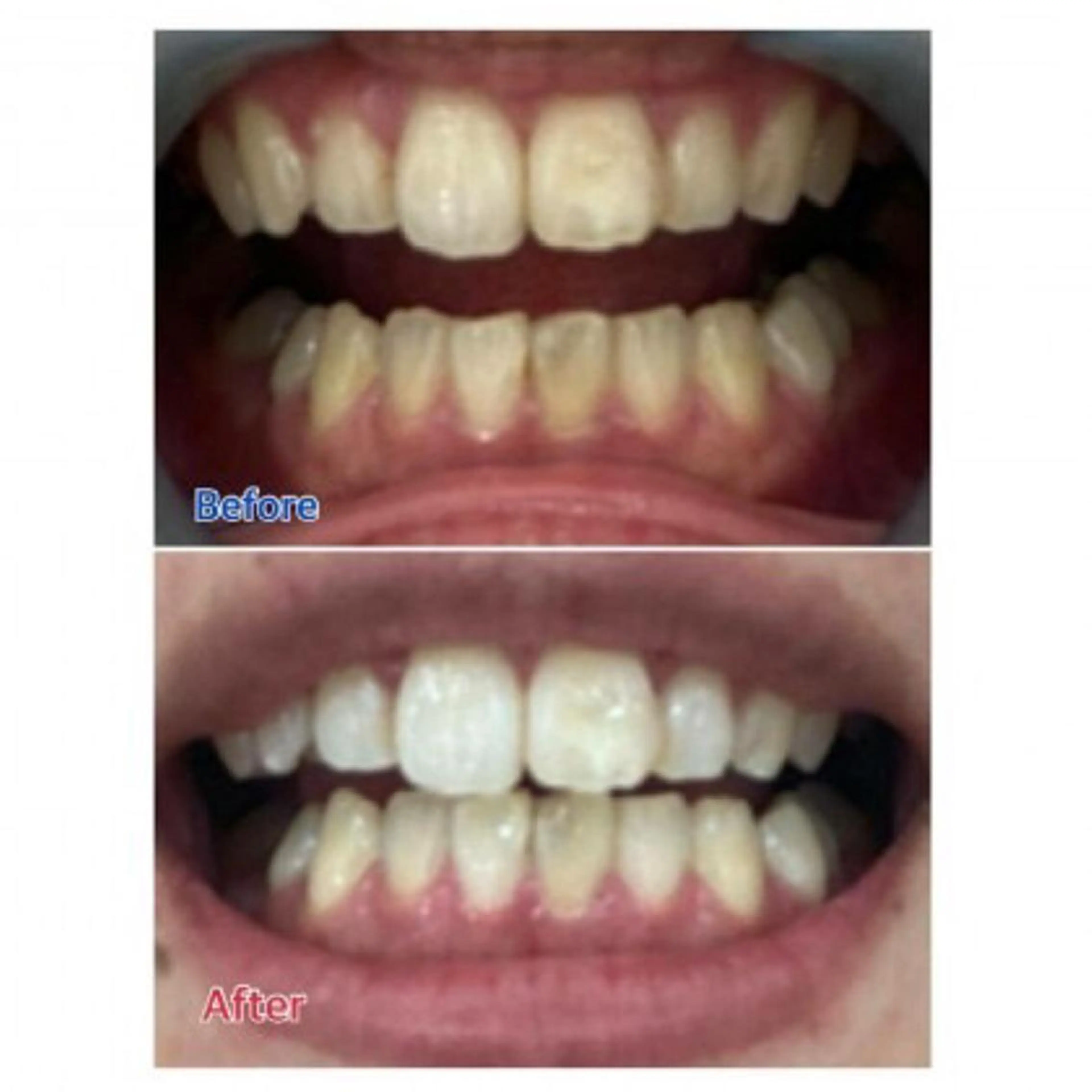 M渋谷店所属・Ｍ渋谷 ホワイトニングのエステ・リラクイメージ