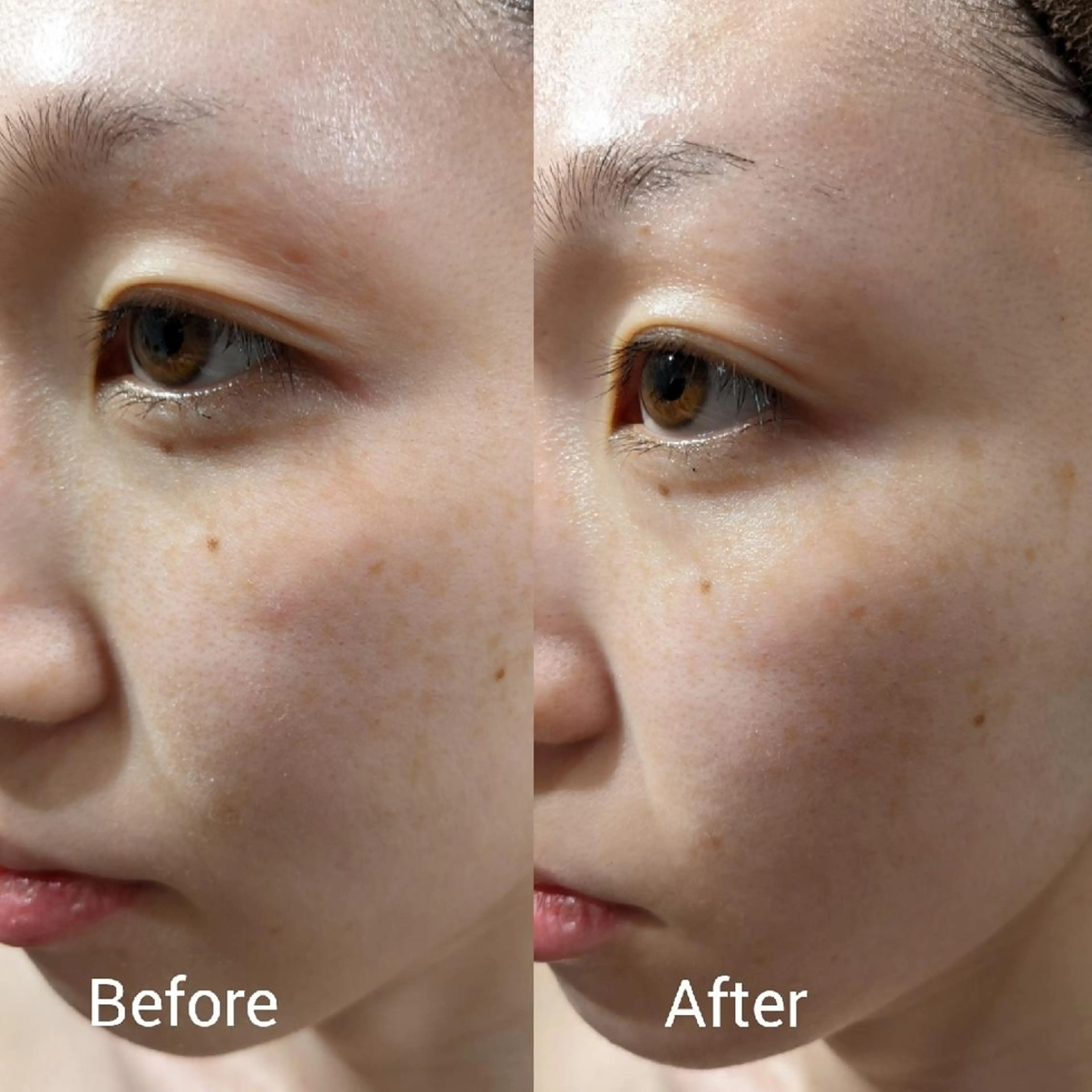 ﾌｪｲｼｬﾙｴｽﾃ ﾗﾄｩｰﾙ伊深のエステ・リラクイメージ