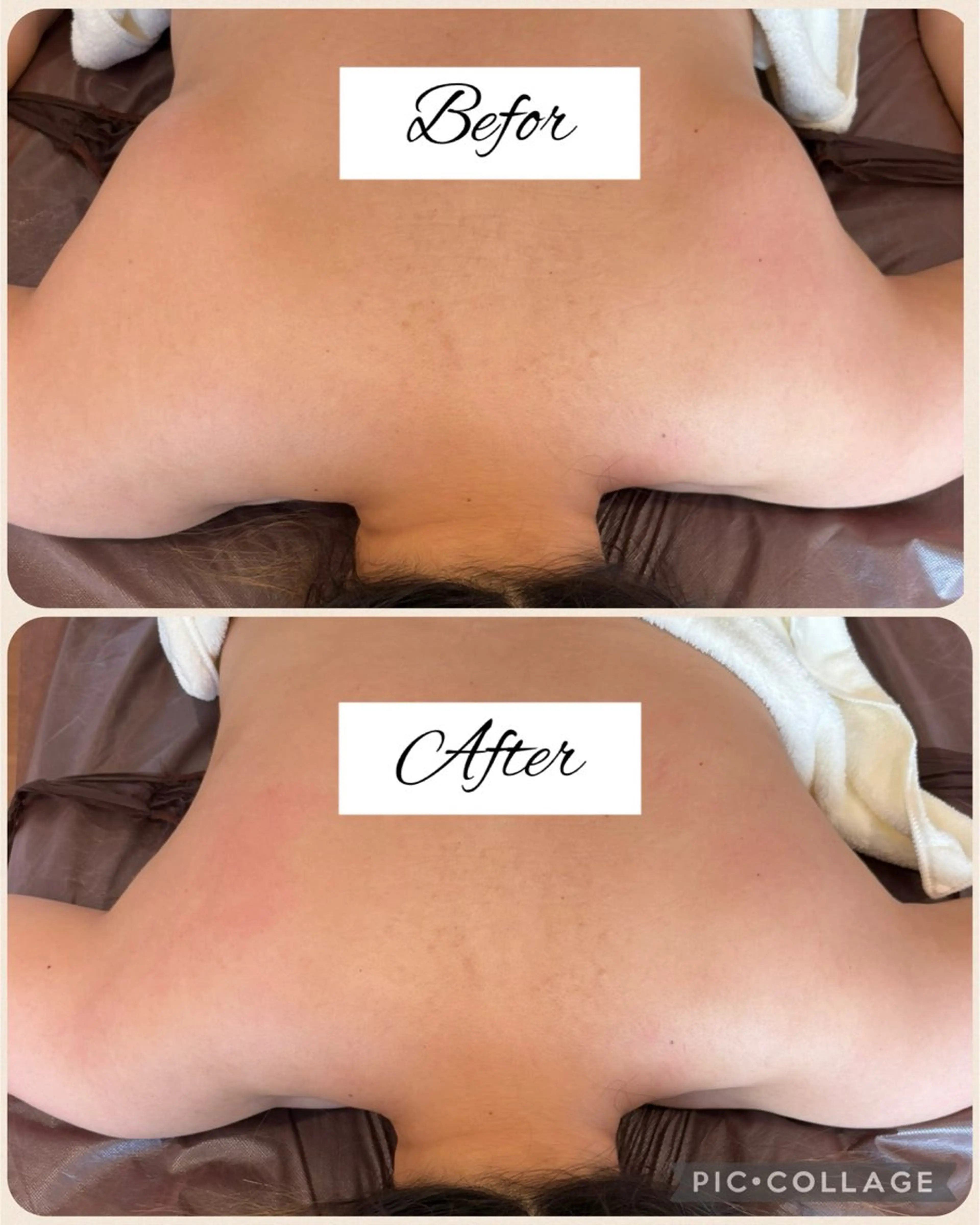 エステ 筋膜リリース専門サロンEmbellir所属・筋膜リリースサロン Embellirのエステ・リラクイメージ