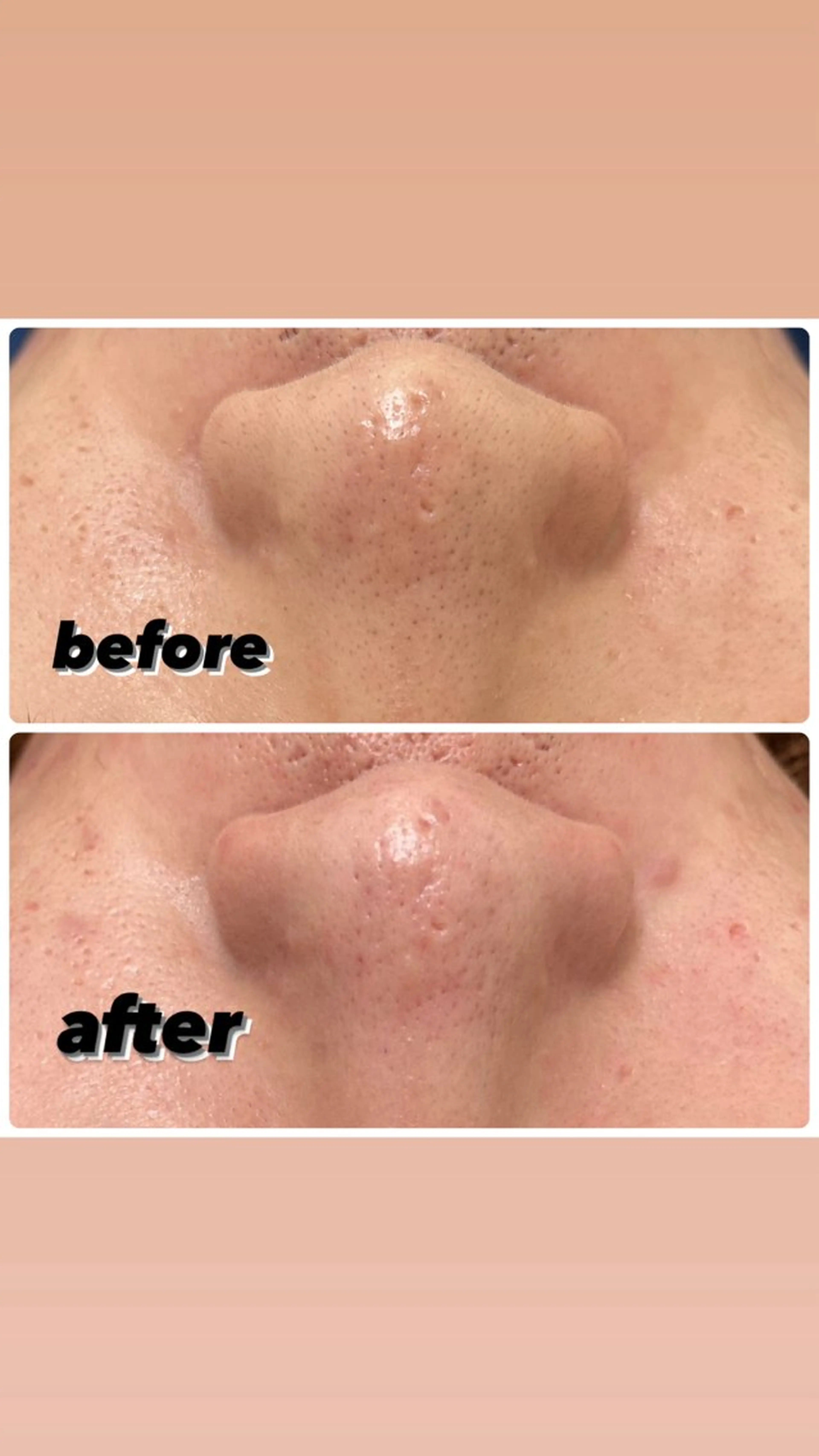 エステ A/S アズのエステ・リラクイメージ