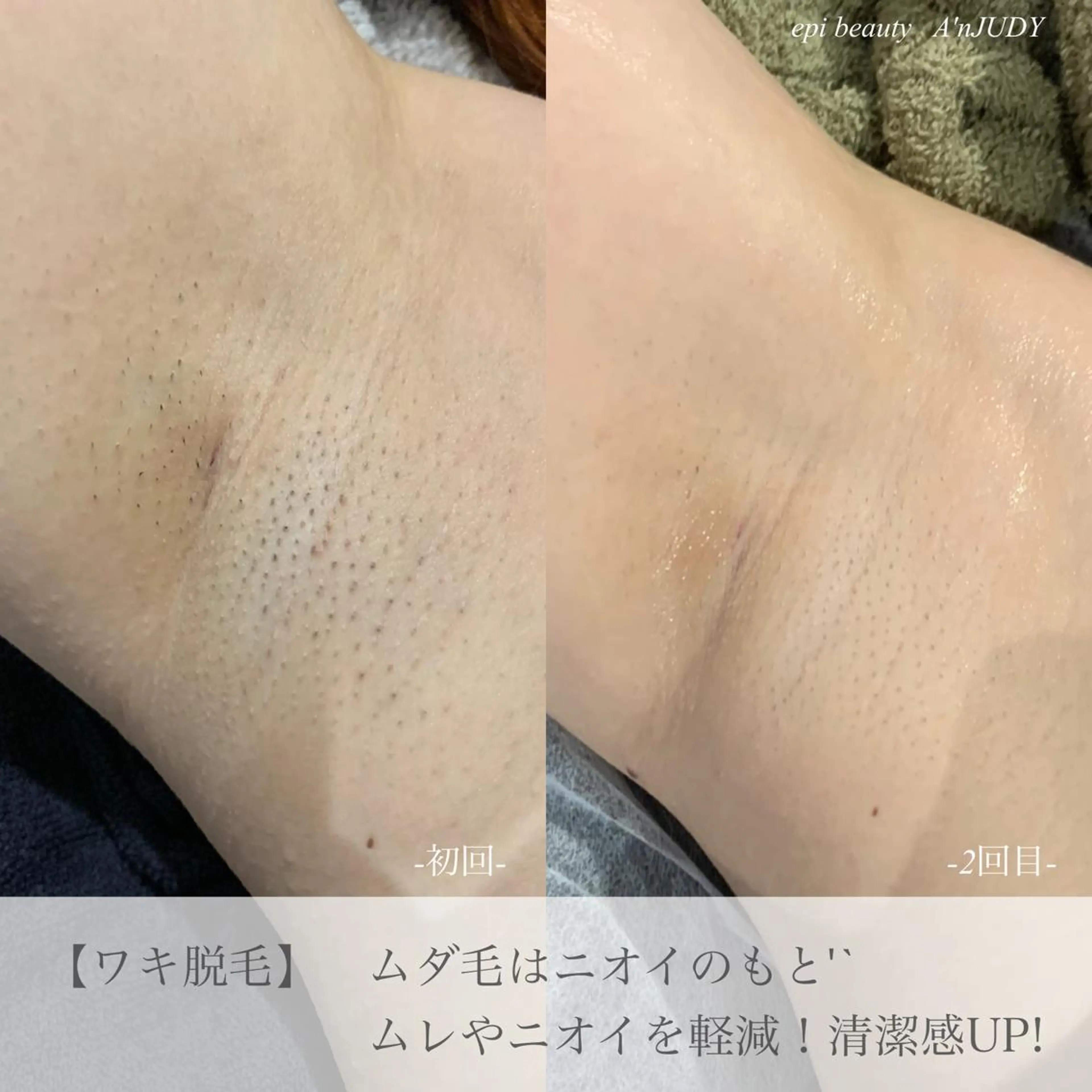 脱毛&ビューティー A'nJUDYの眉毛・アイブロウイメージ