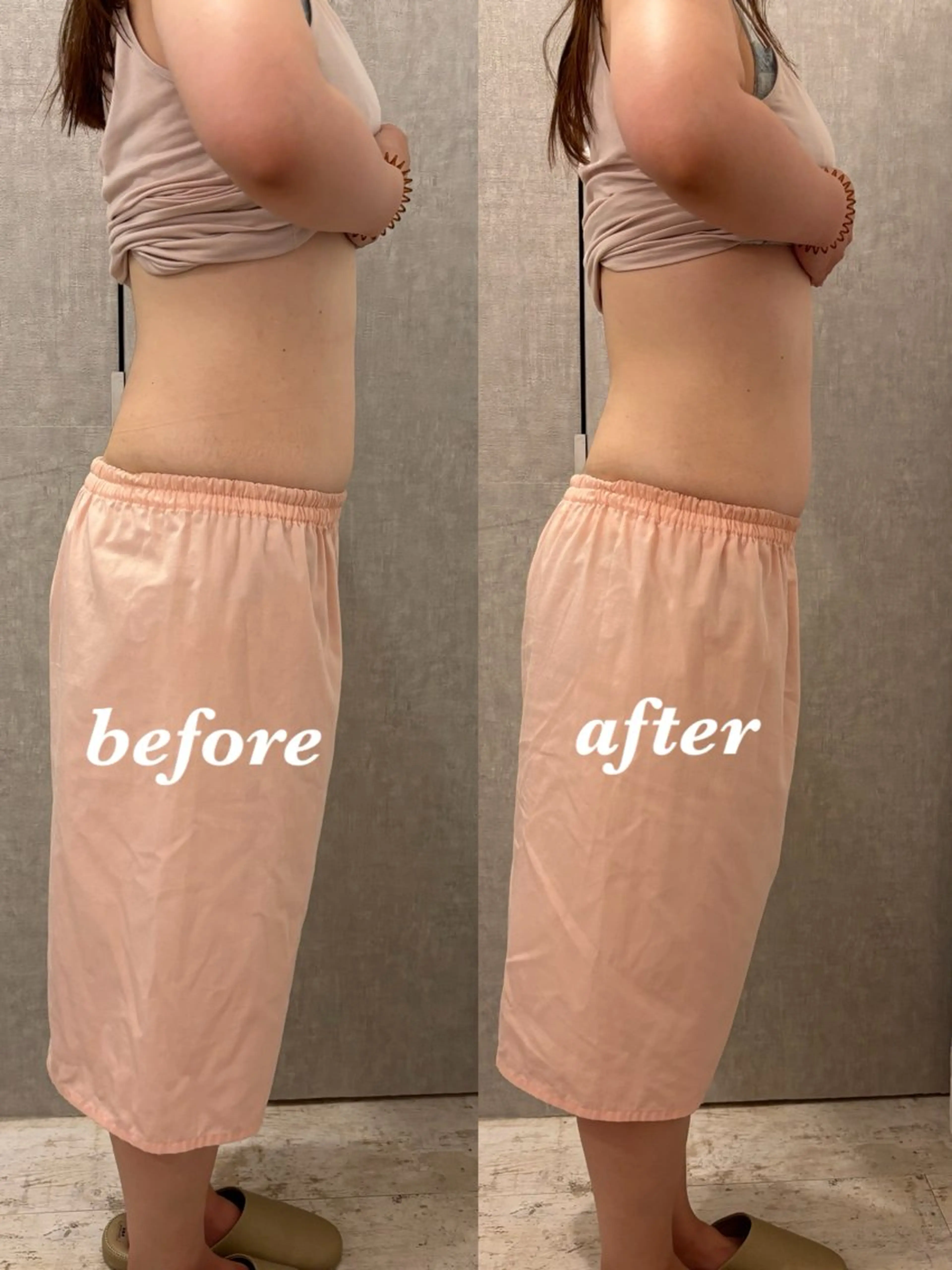 エステ リラク 腸活サポート みなみののエステ・リラクイメージ