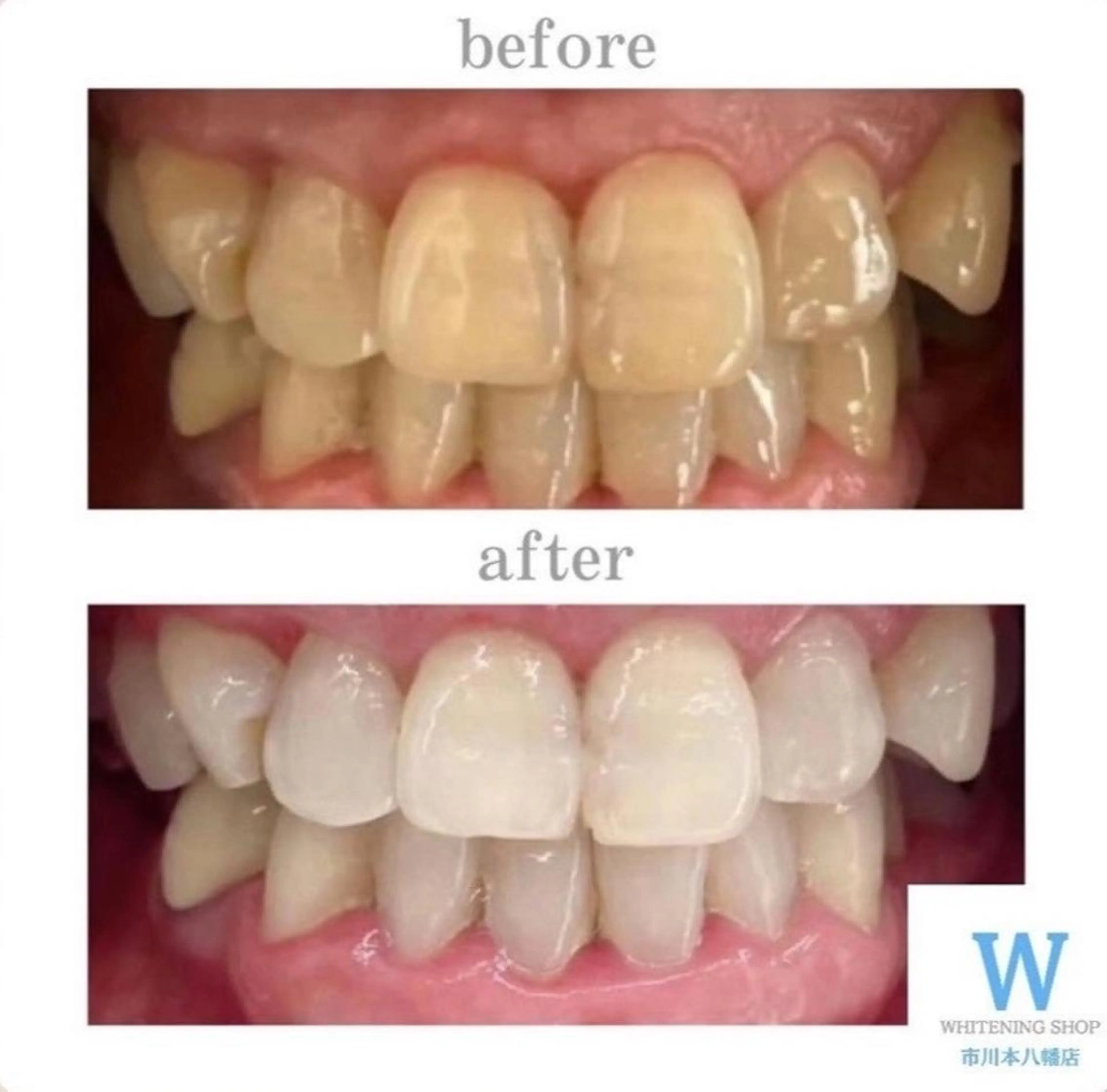 エステ リラク ホワイトニング ショップ本八幡店のエステ・リラクイメージ