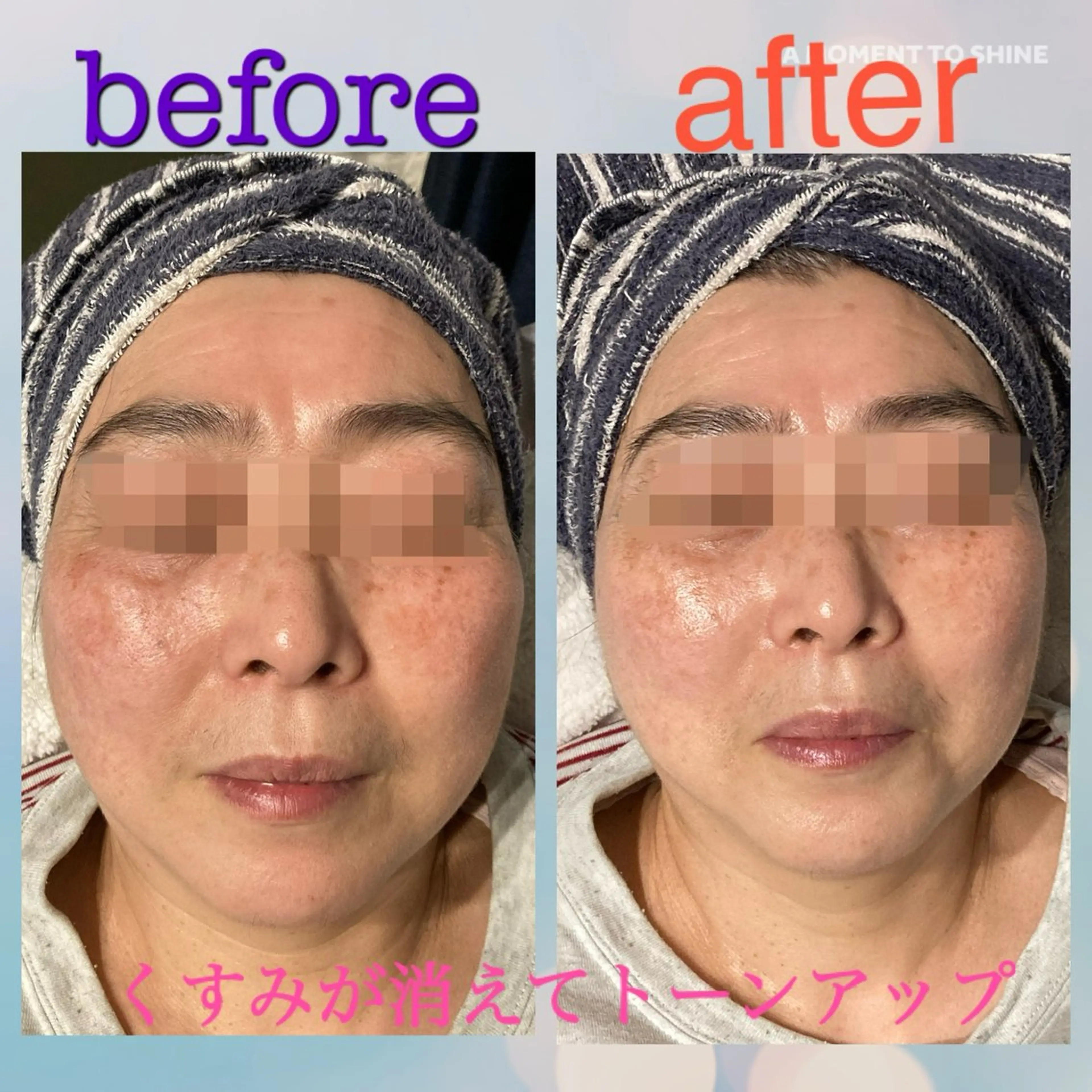 エステ プレジール所属・ビューティサロン プレジールOTAKEのエステ・リラクイメージ