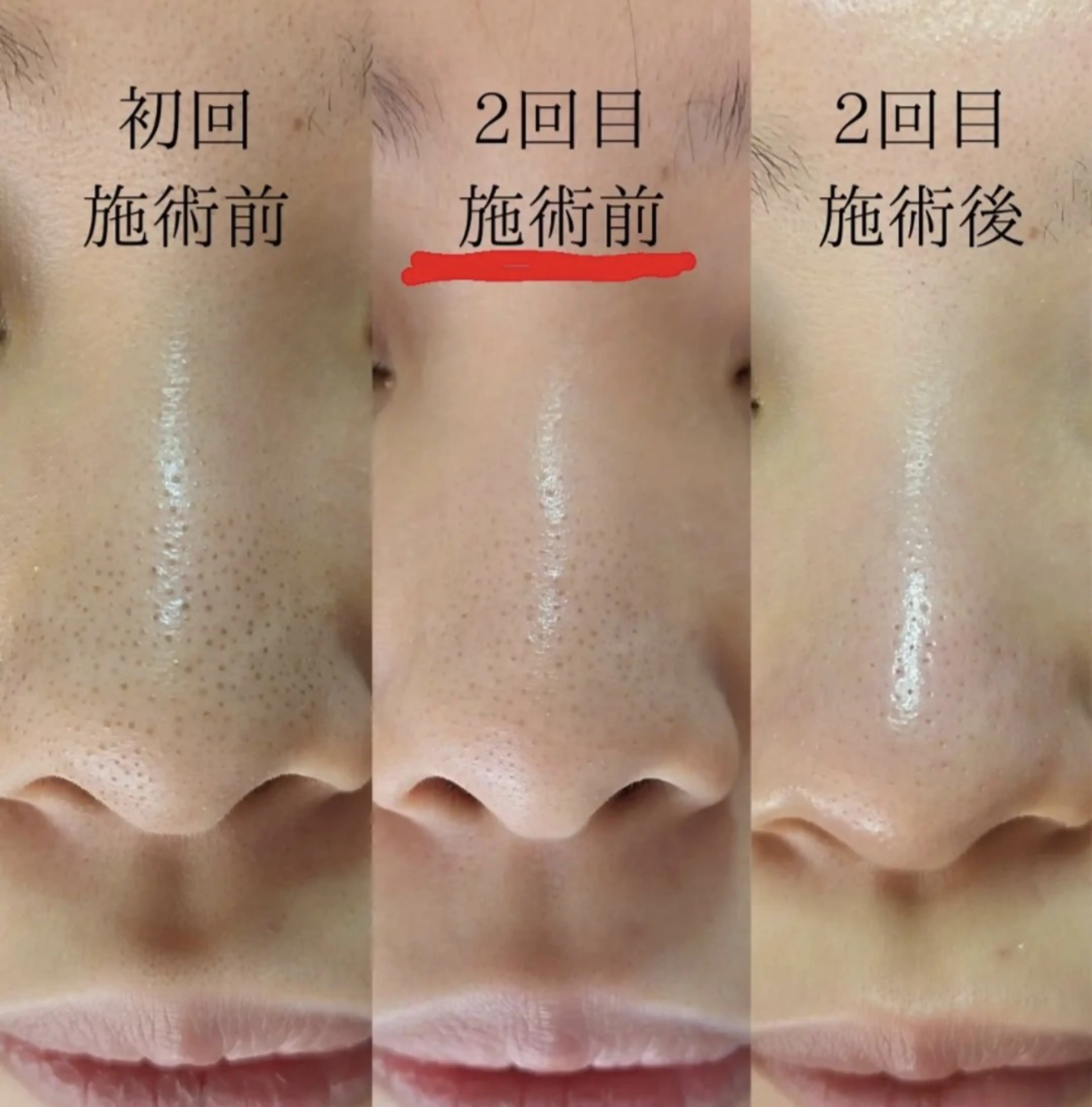  毛穴洗浄・まつ毛 の専門店 ソラーレのエステ・リラクイメージ