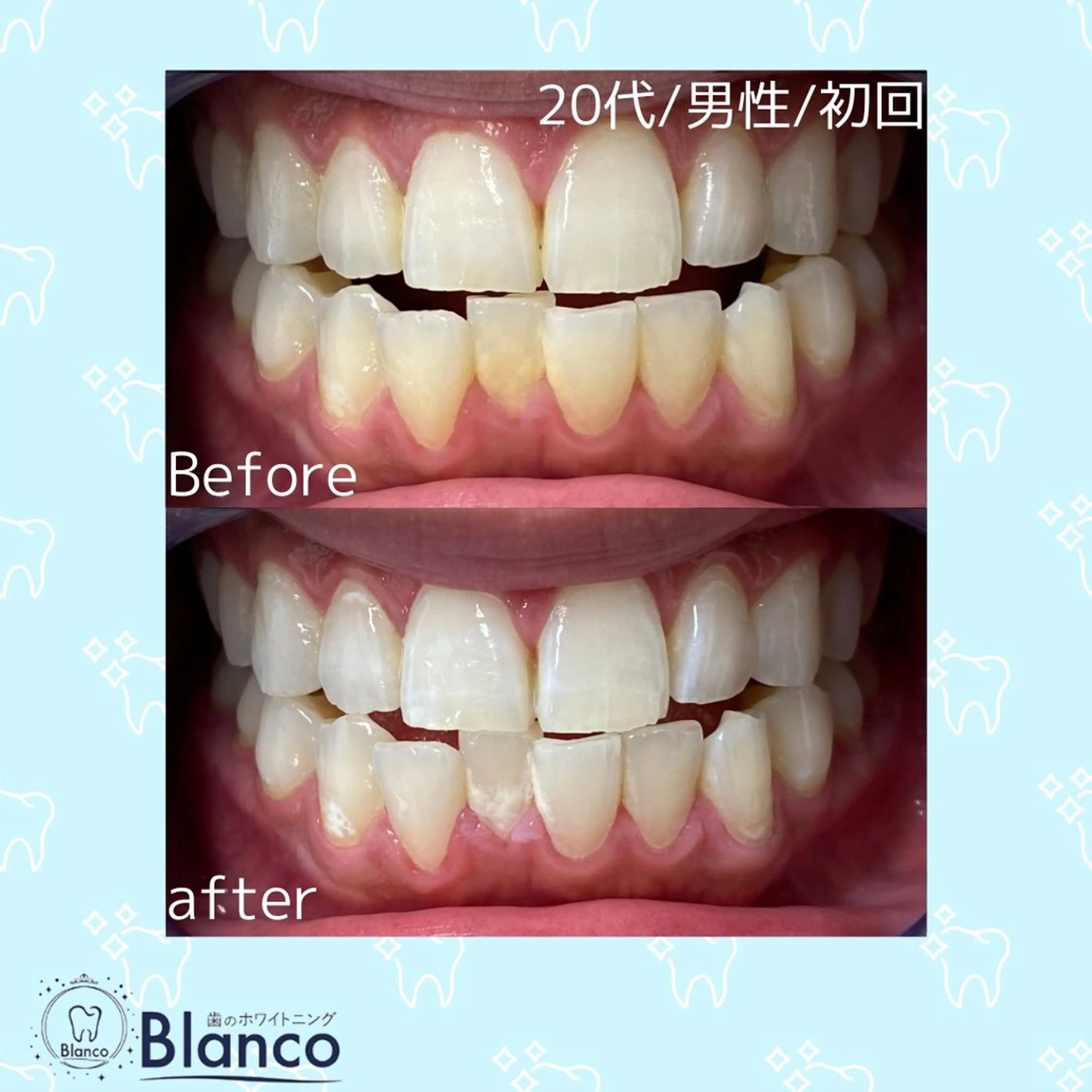 その他 Blanco川口駅前店所属・Blanco 川口駅前店のその他イメージ