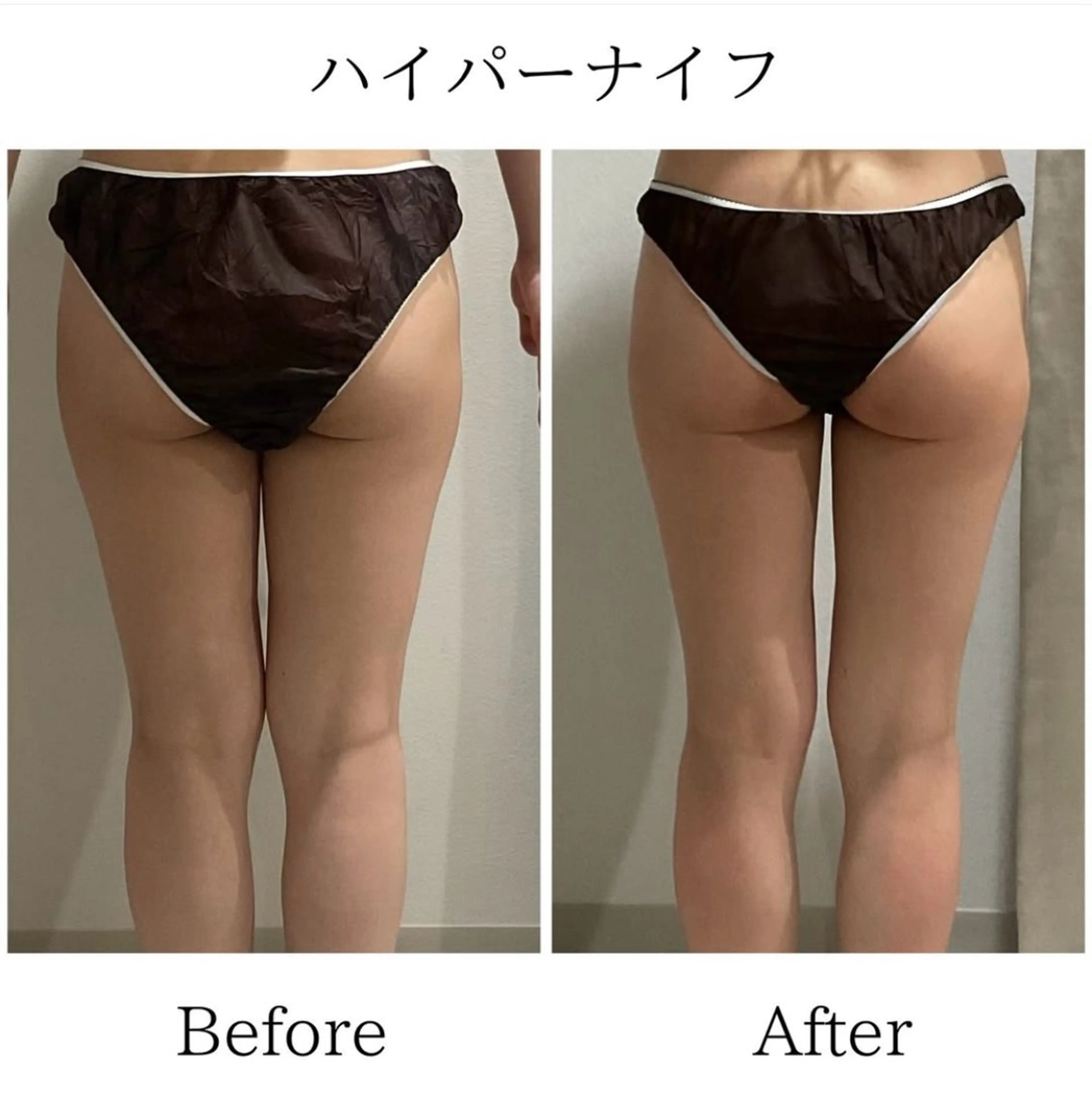 エステ LiLL by Andre beauty所属・LiLL 熊本のその他イメージ