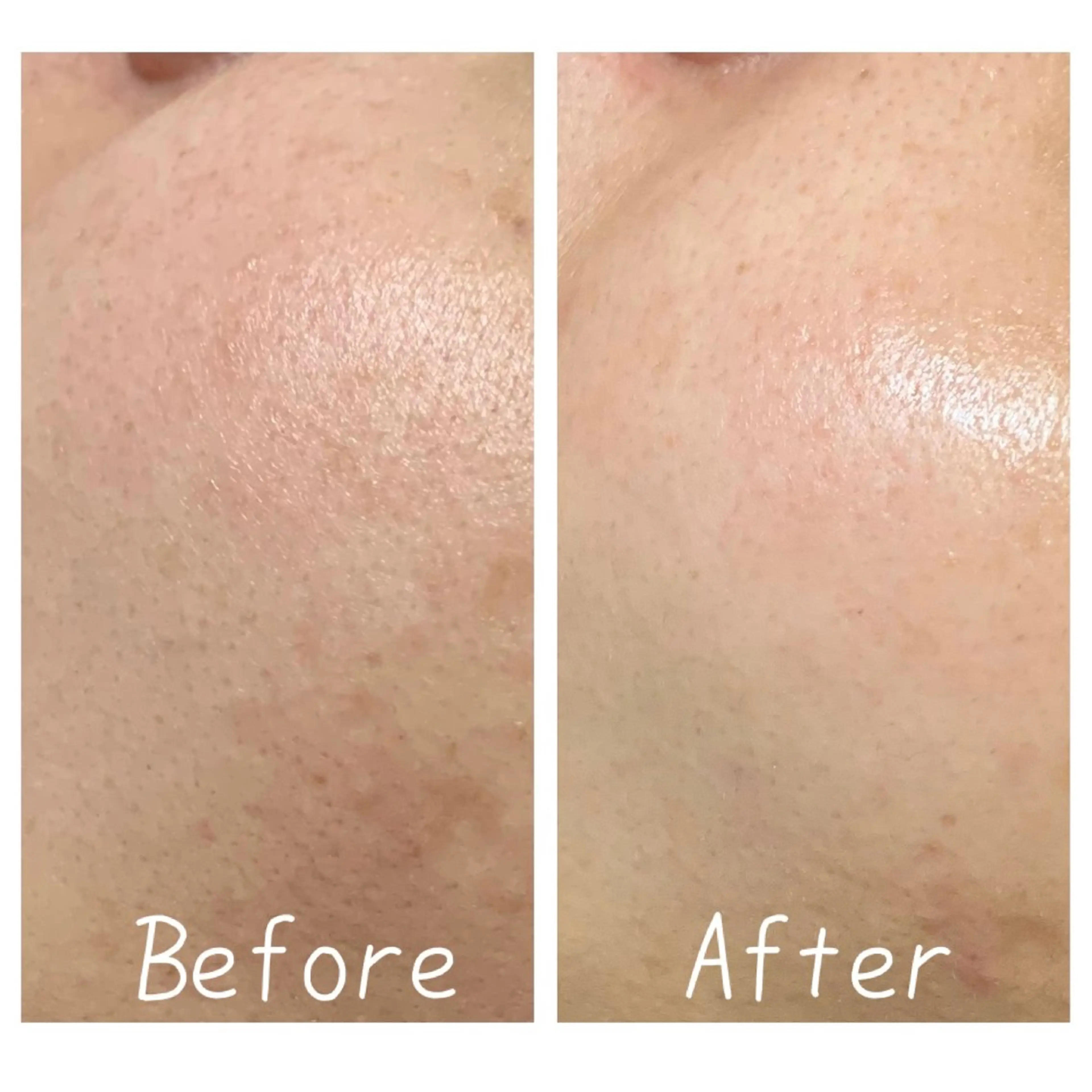 肌質改善Charme coco  増毛のエステ・リラクイメージ