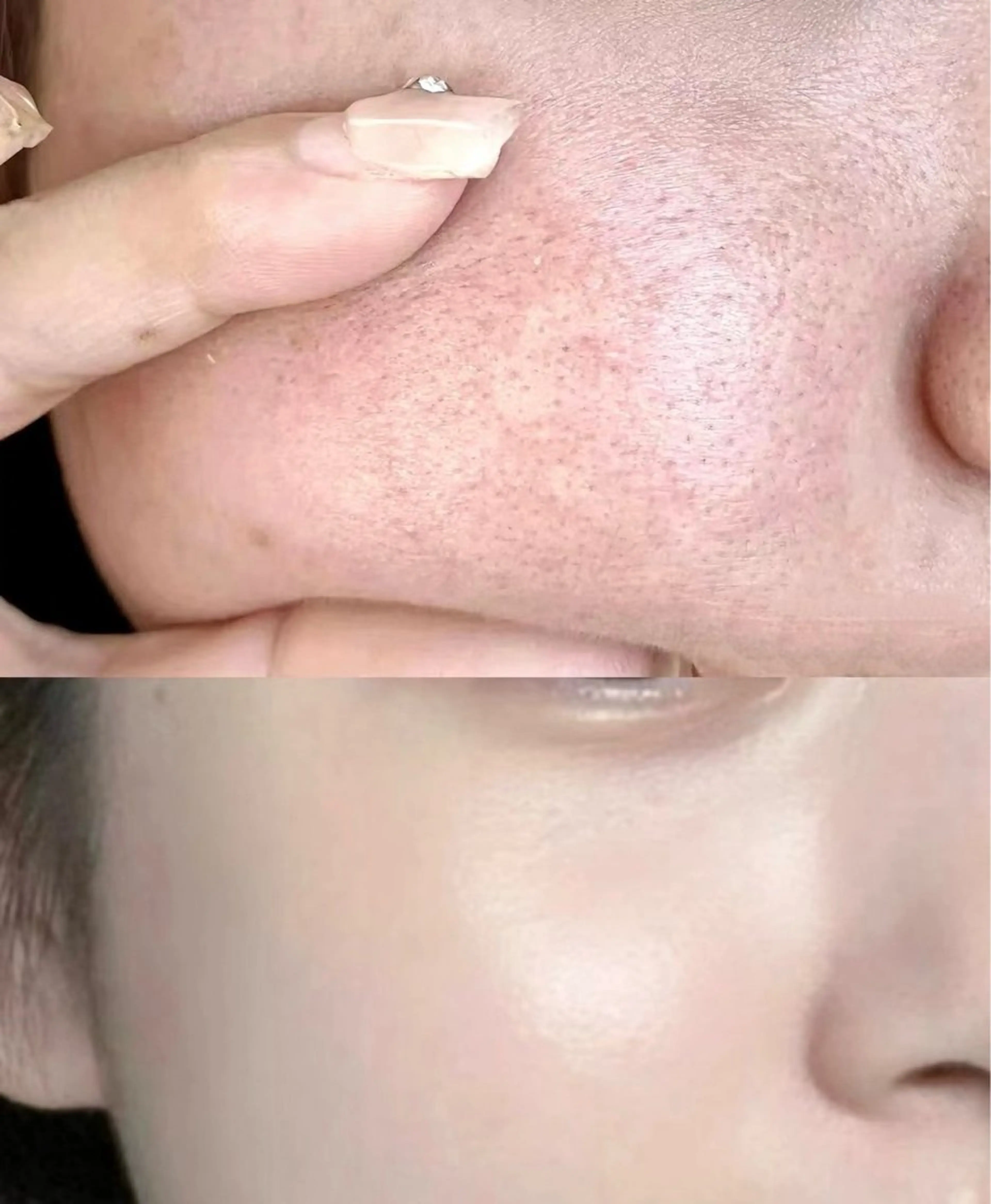 エステ リラク 愛維美水光美肌専門店所属・愛維美水光美肌専門店 メンズレディースokのエステ・リラクイメージ