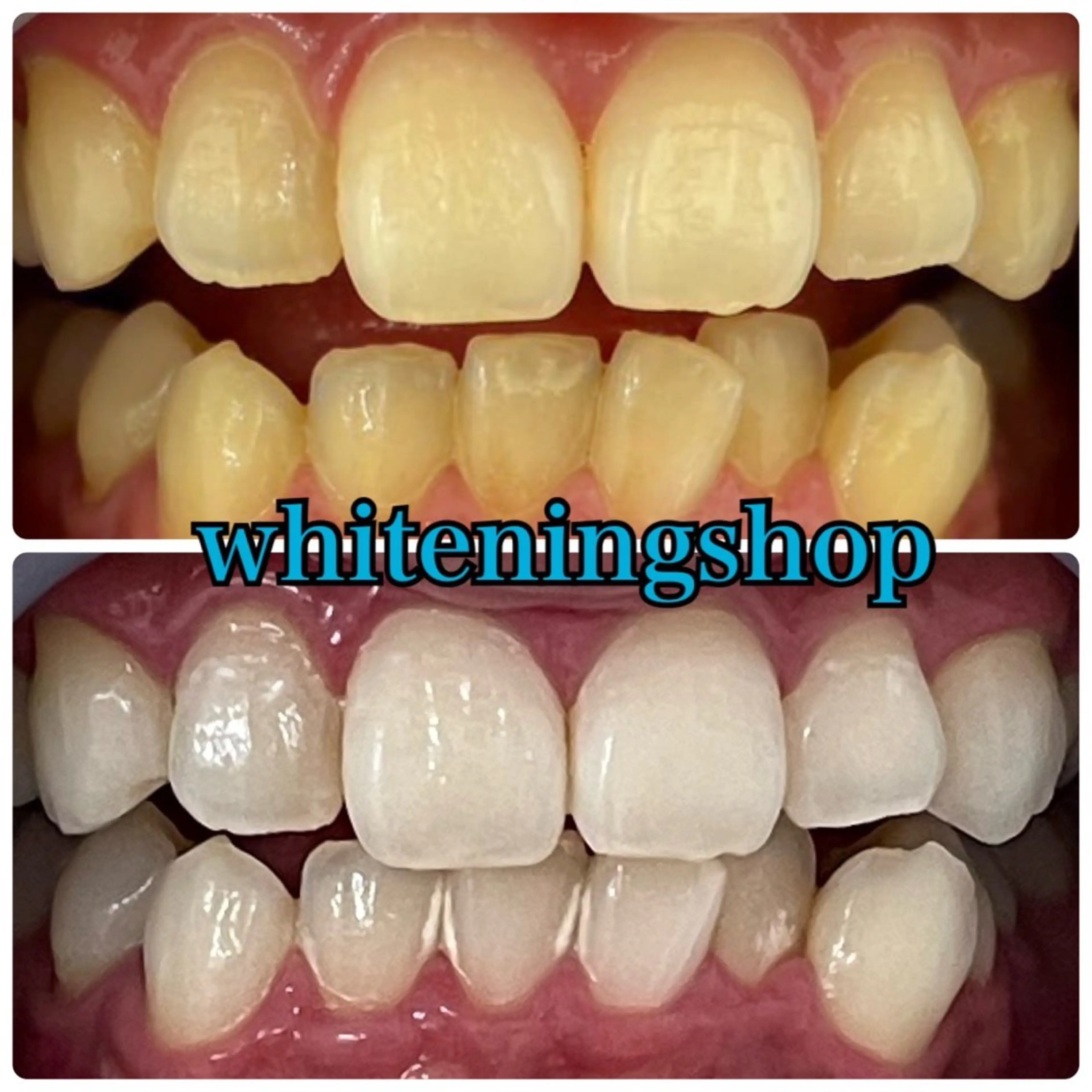 エステ リラク ホワイトニング ショップ吉祥寺店のエステ・リラクイメージ