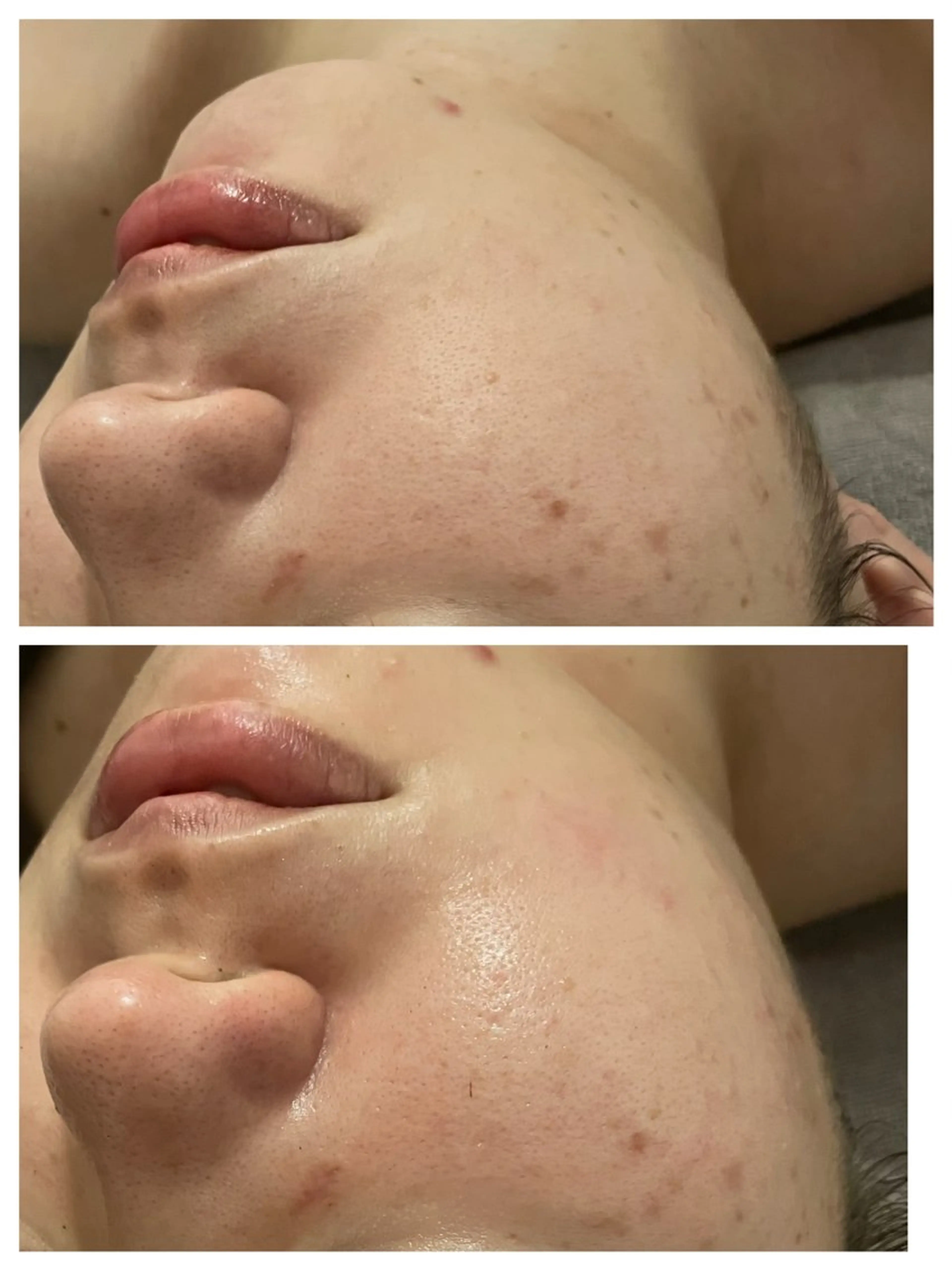 アロマオイルリンパ マッサージ💆‍♀️のエステ・リラクイメージ