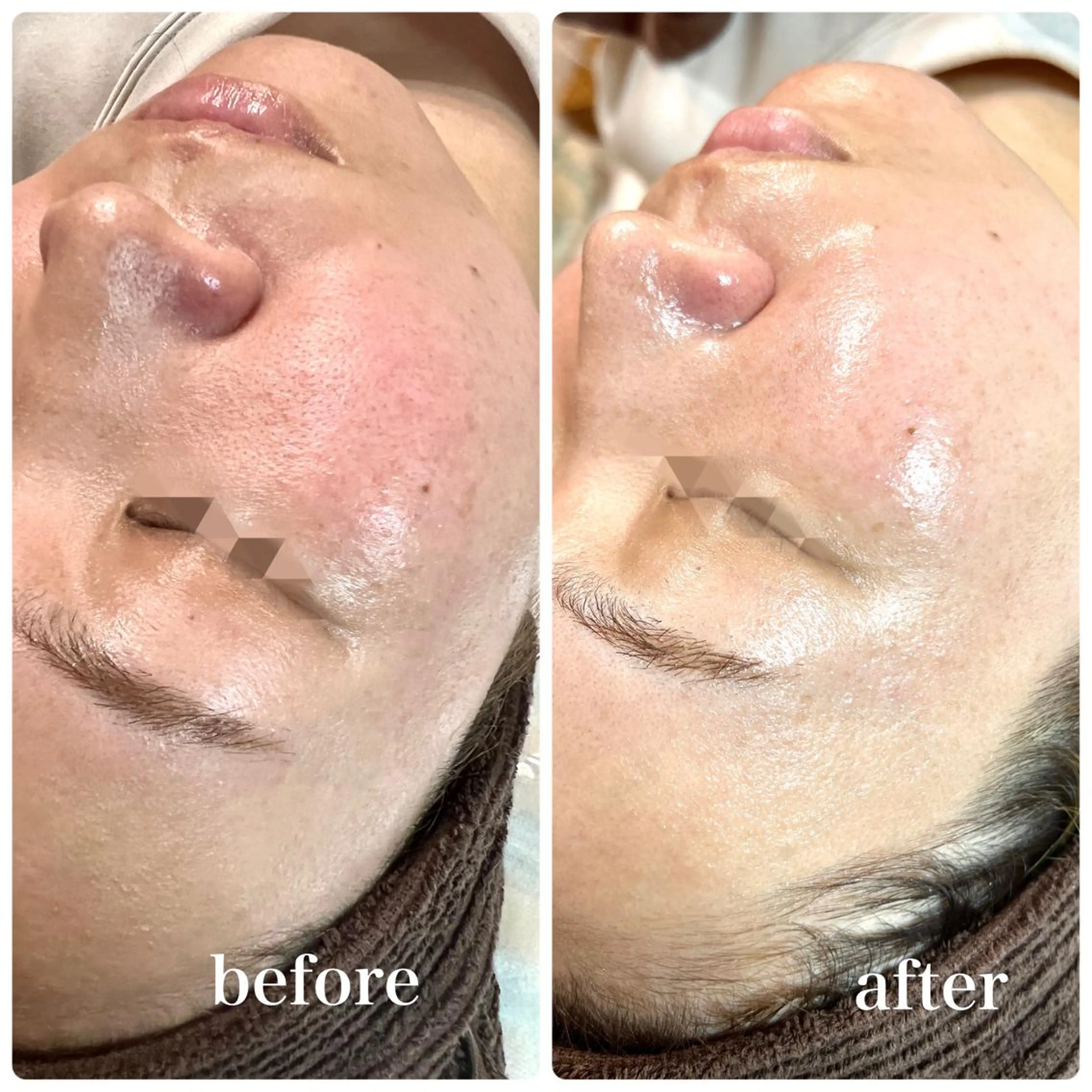 CHICIEL所属・枚方市香里園脱毛 サロンCHICIELのエステ・リラクイメージ