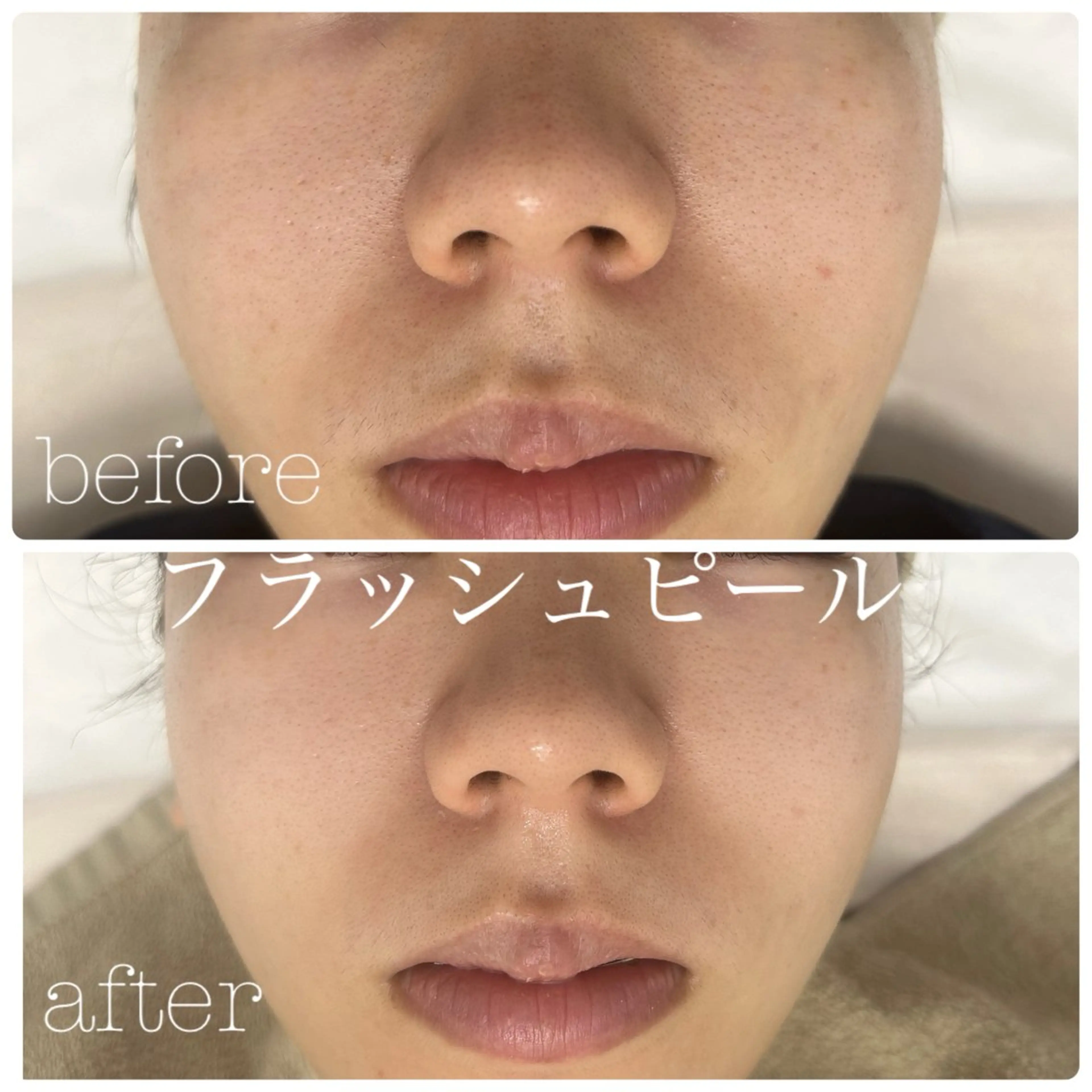 メンズ エステ フェイシャルサロン CHIARA 荒田のエステ・リラクイメージ