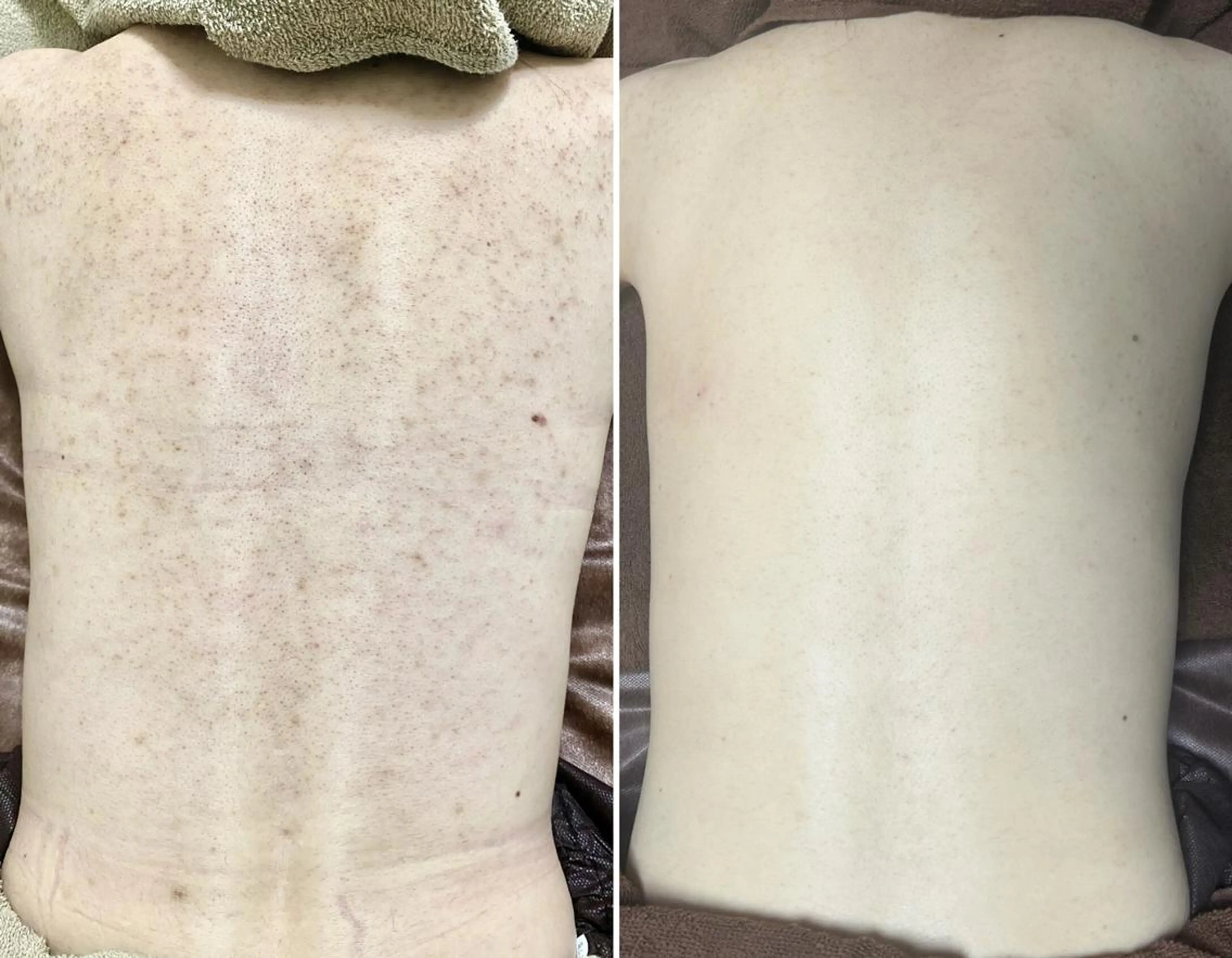 エステ NOBLE 新宿南口店のエステ・リラクイメージ