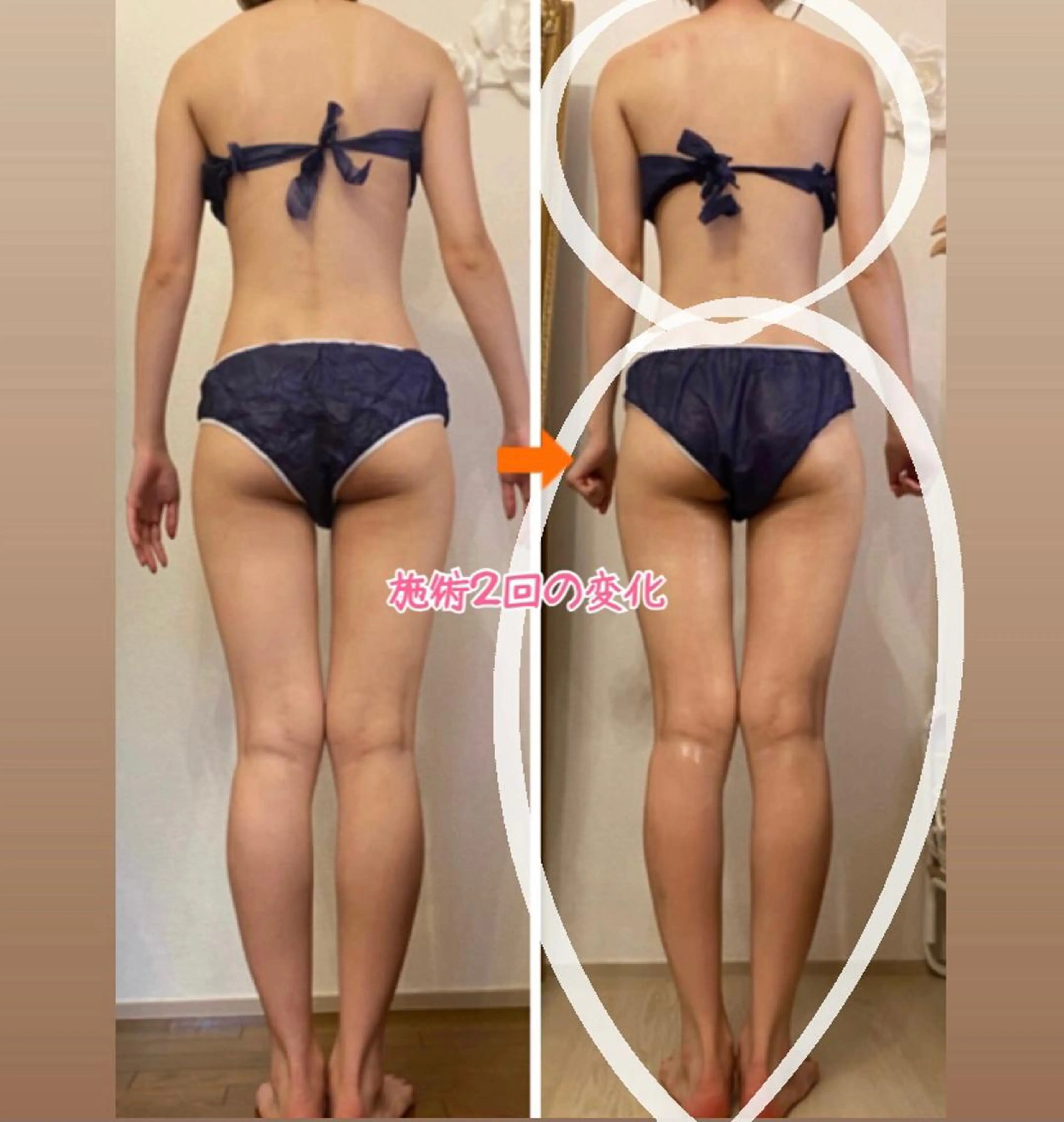 ショート ‍痩身＆ボディ 結果出し🌟丹野のエステ・リラクイメージ