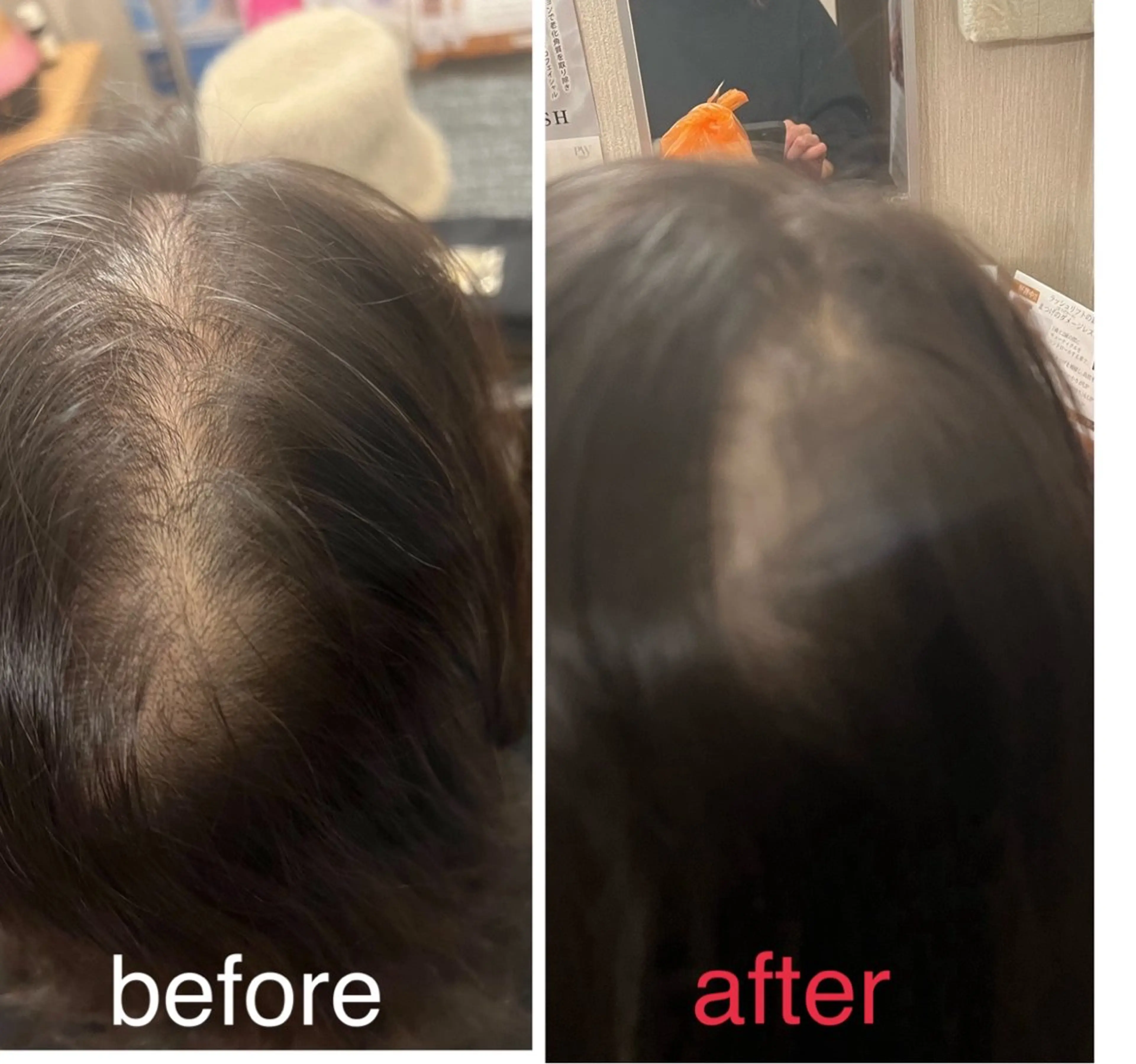 毛穴小顔・痩身サロン メイク・ド・ミュウのその他イメージ