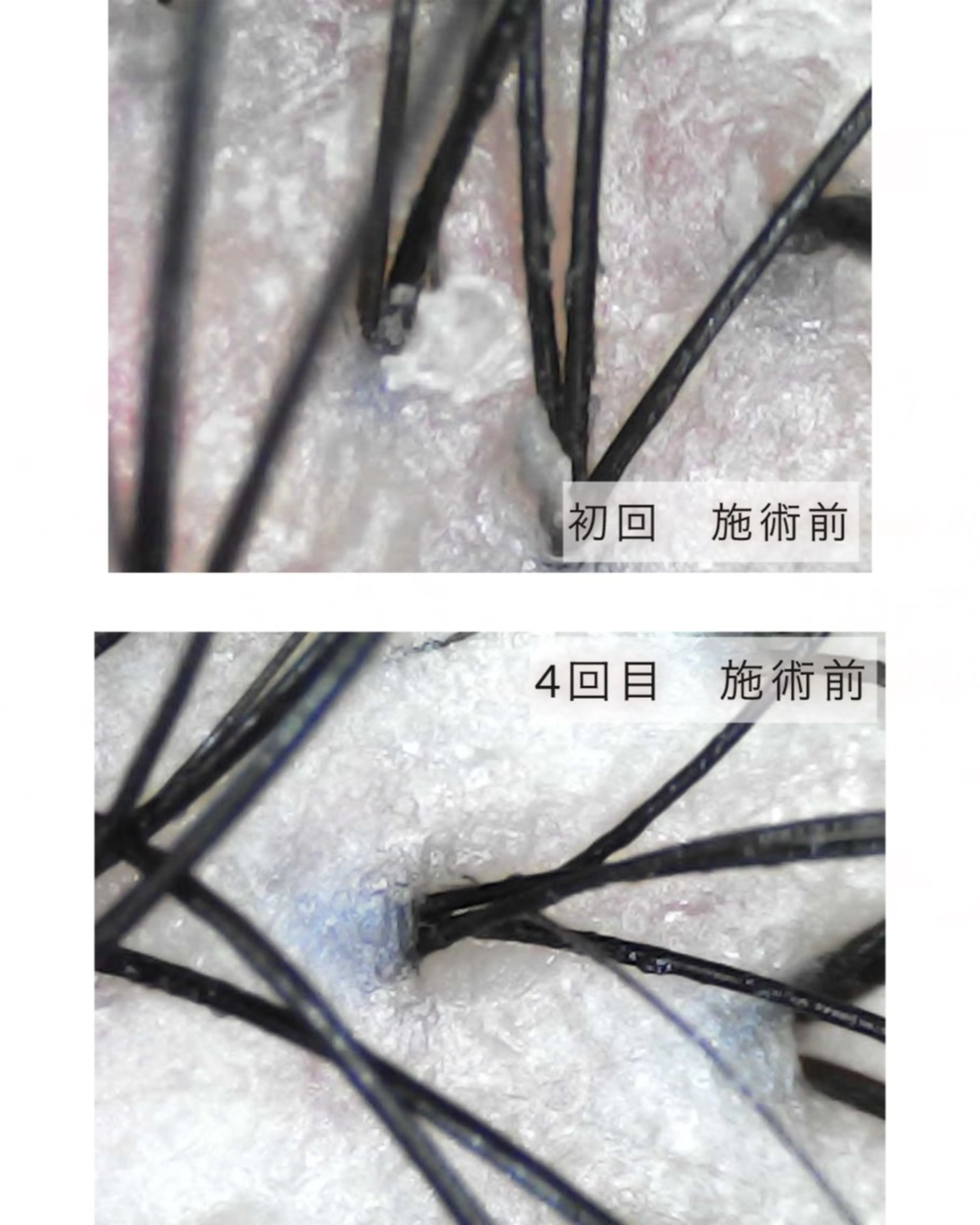 ヘッドスパ salowin 郡山店所属・中畑 莉菜のヘアスタイル