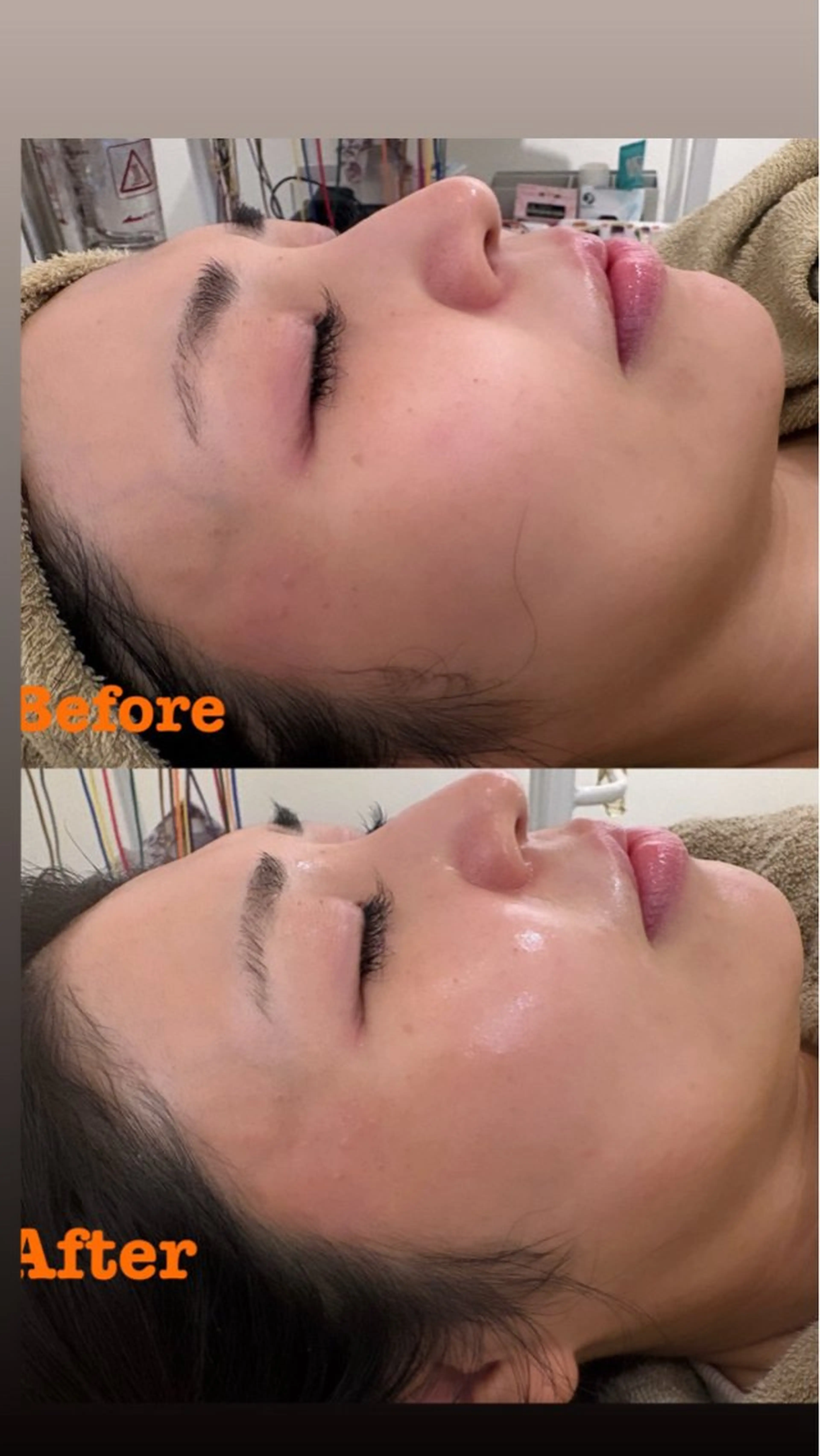 エステ リラク 美容鍼灸サロン mahoroba院長のエステ・リラクイメージ