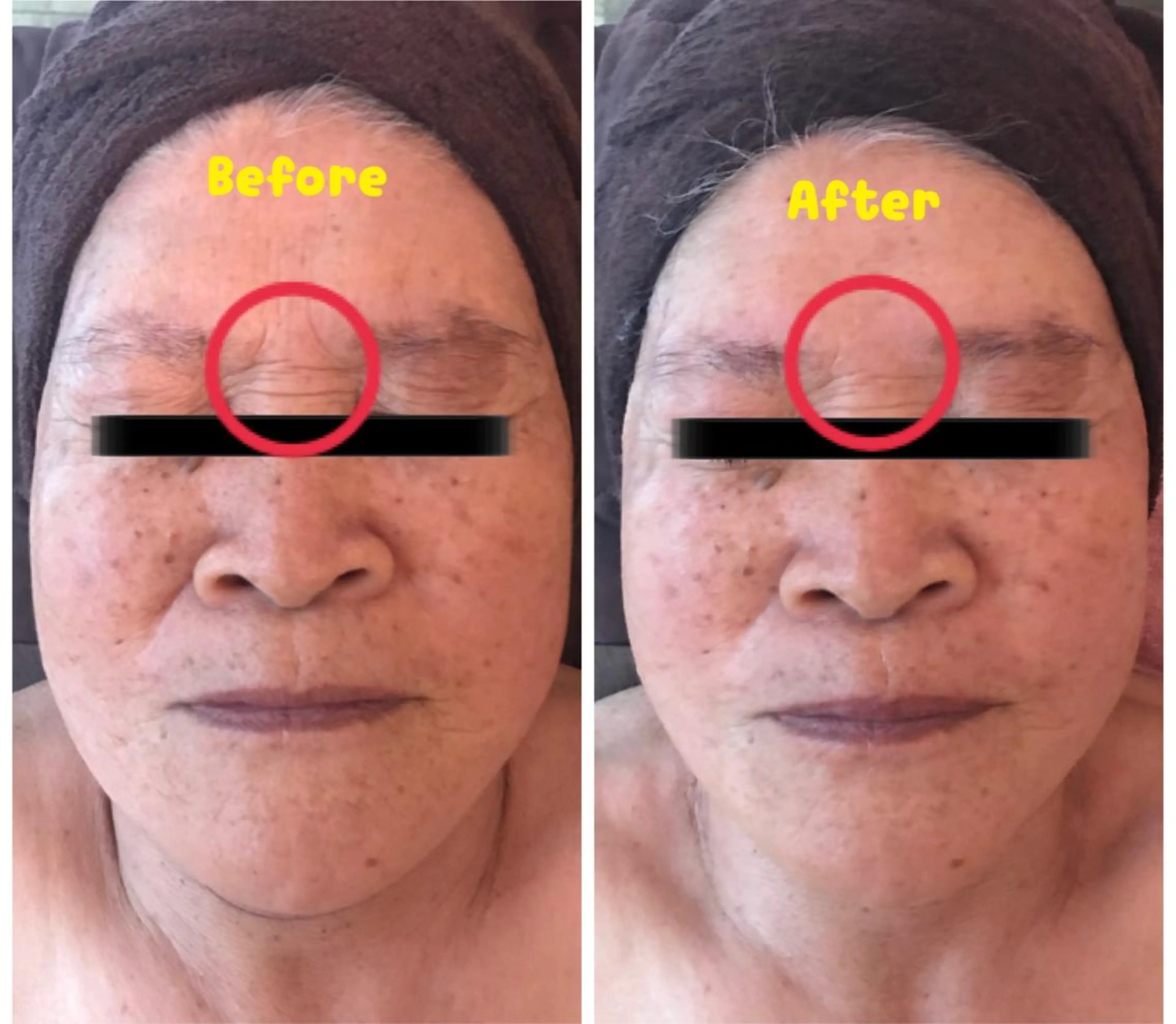 代表 MOMOのエステ・リラクイメージ