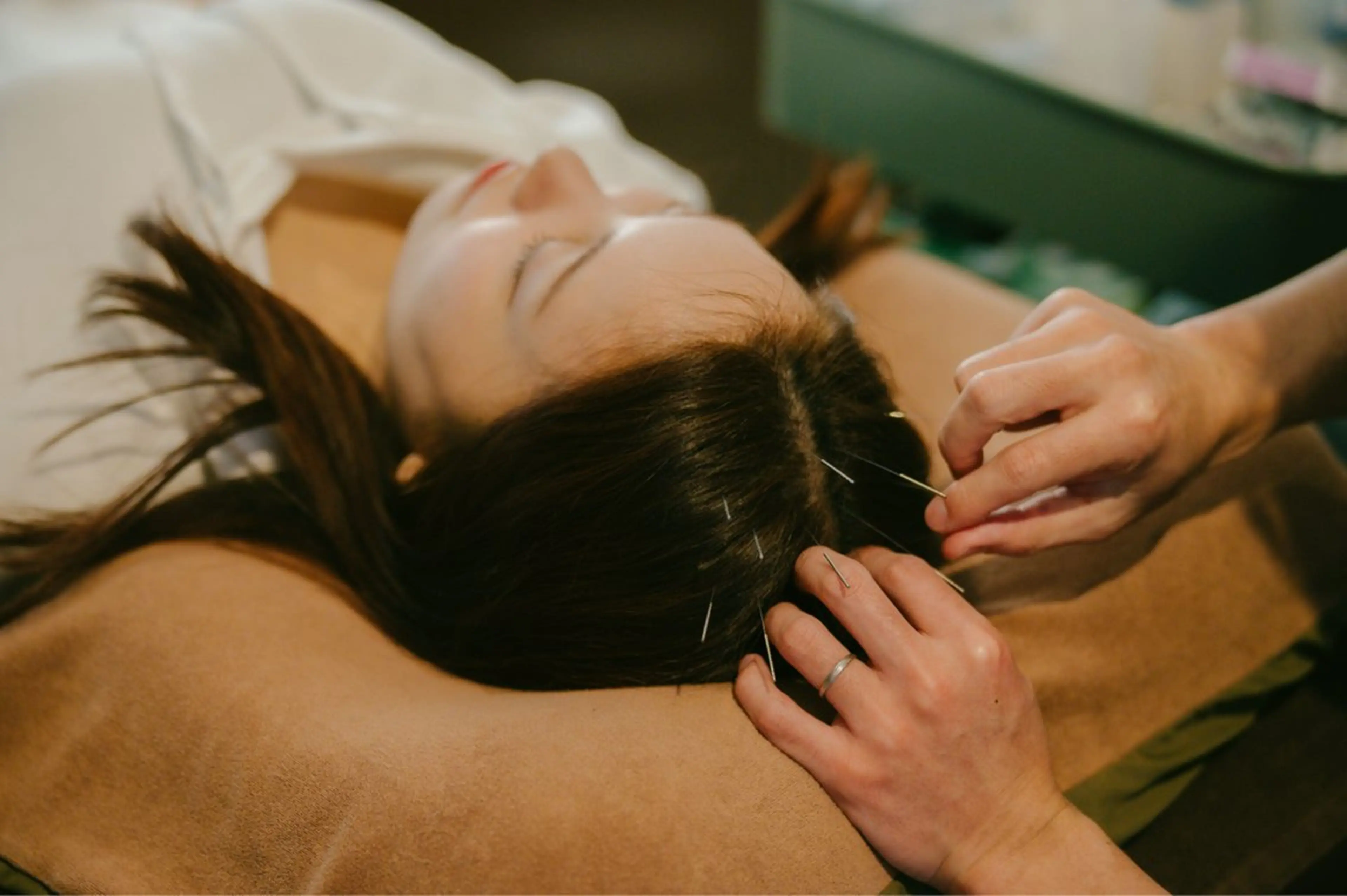 育毛プログラム初回お試しコースの写真