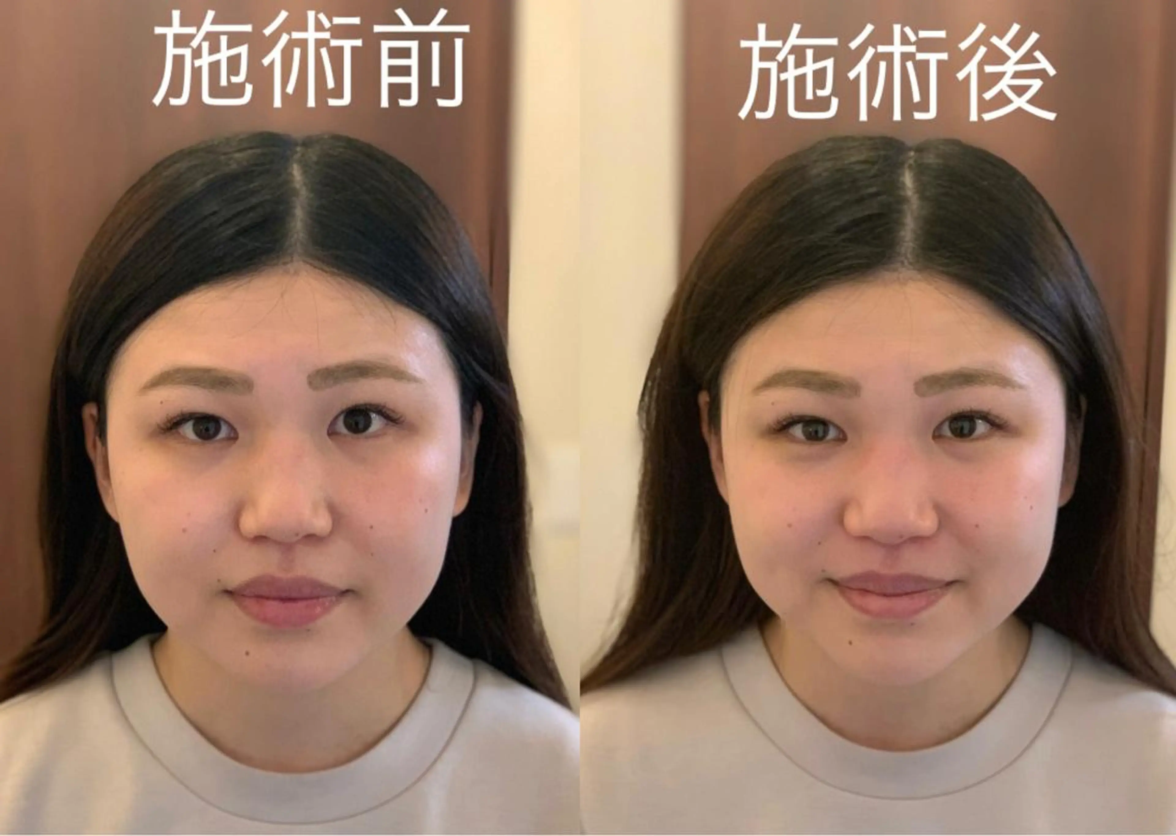 整体フェイシャル EMINALのエステ・リラクイメージ