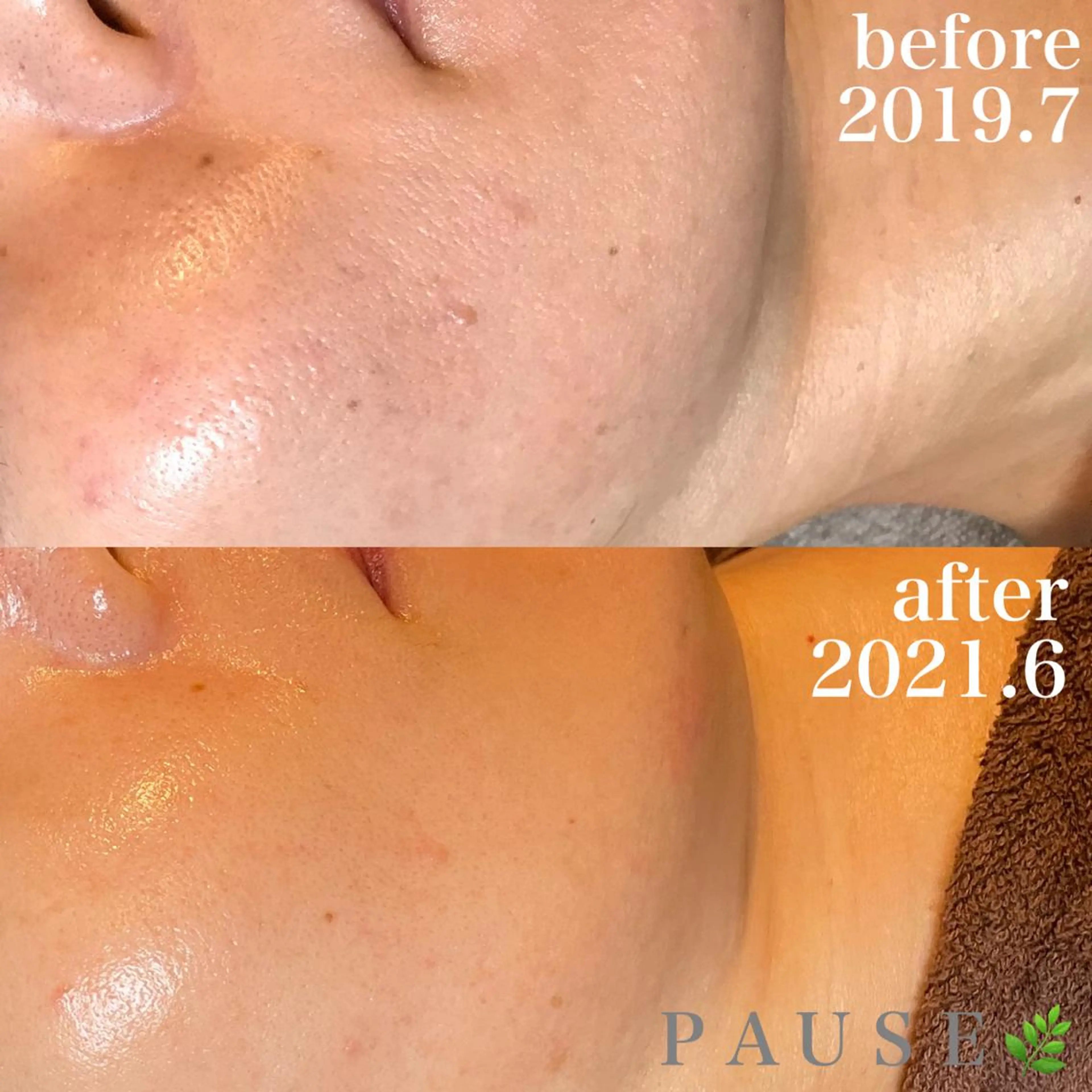 エステ 浜野 恵美のエステ・リラクイメージ