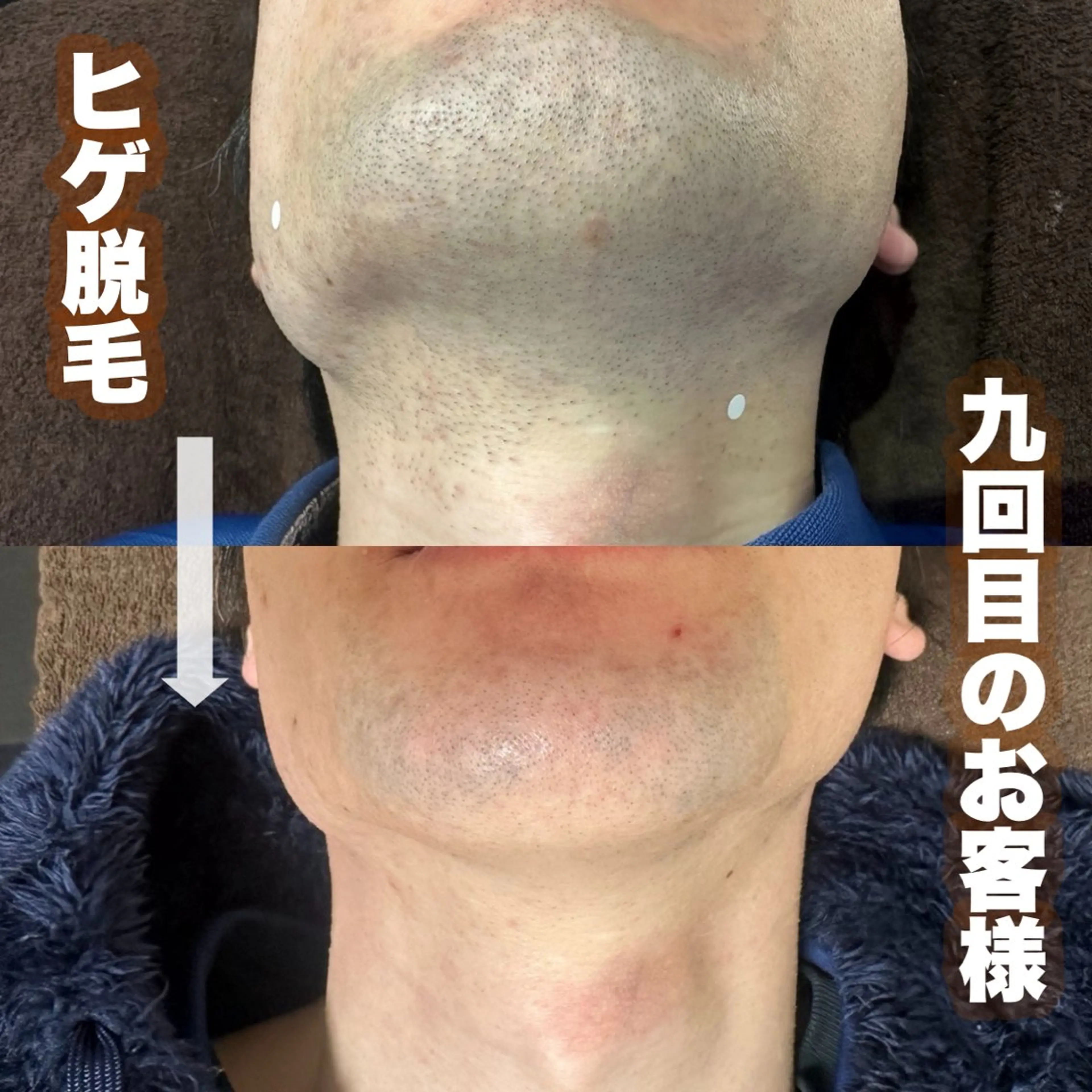 脱毛 beautysalongift所属・gift あすかのマツエク・マツパデザイン