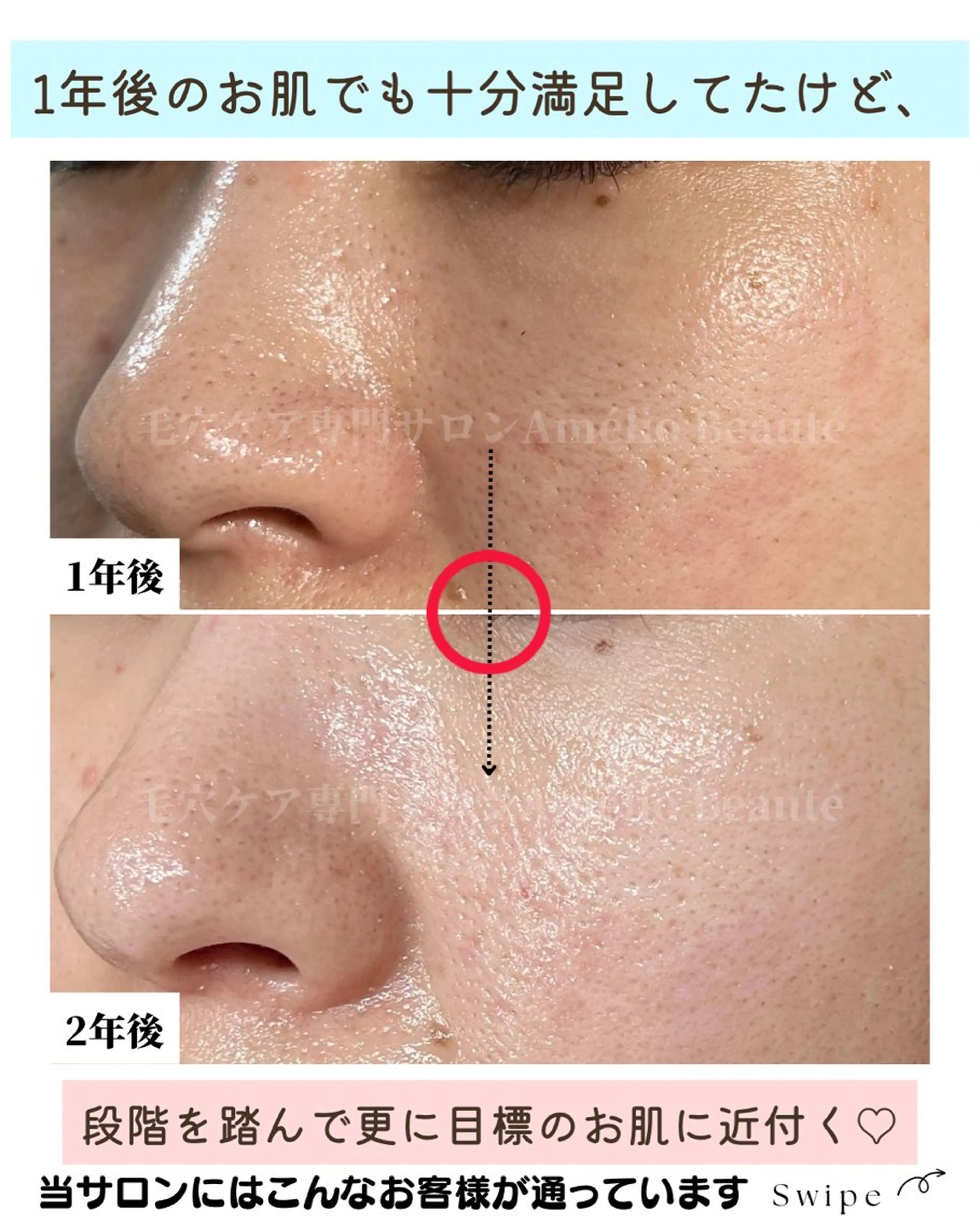 毛穴ケア専門サロン Amélio Beauté所属・毛穴ケア専門サロン アメリオボーテのその他イメージ