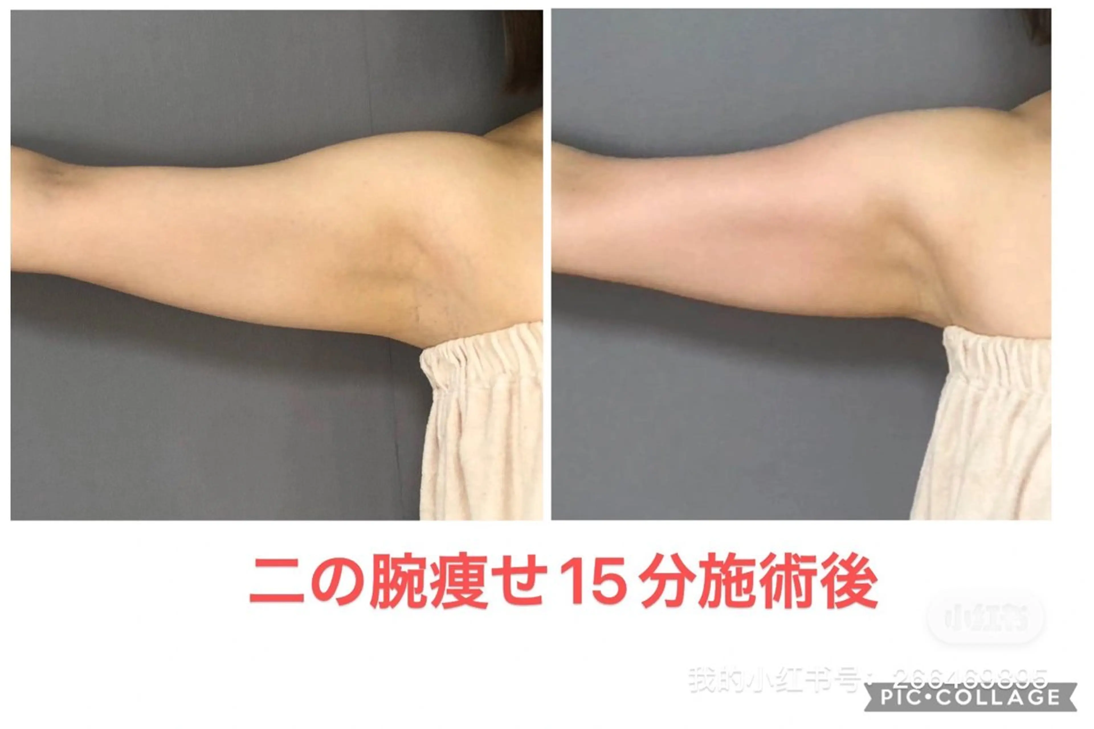 小顔コルギ10年 みなみ・池袋のエステ・リラクイメージ