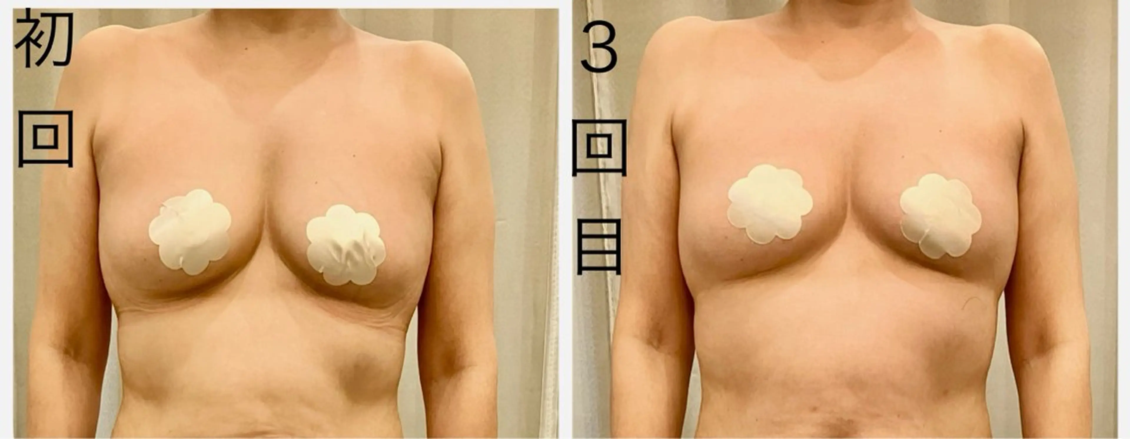 エステ リラク infinity所属・Infinity インフィニティのその他イメージ