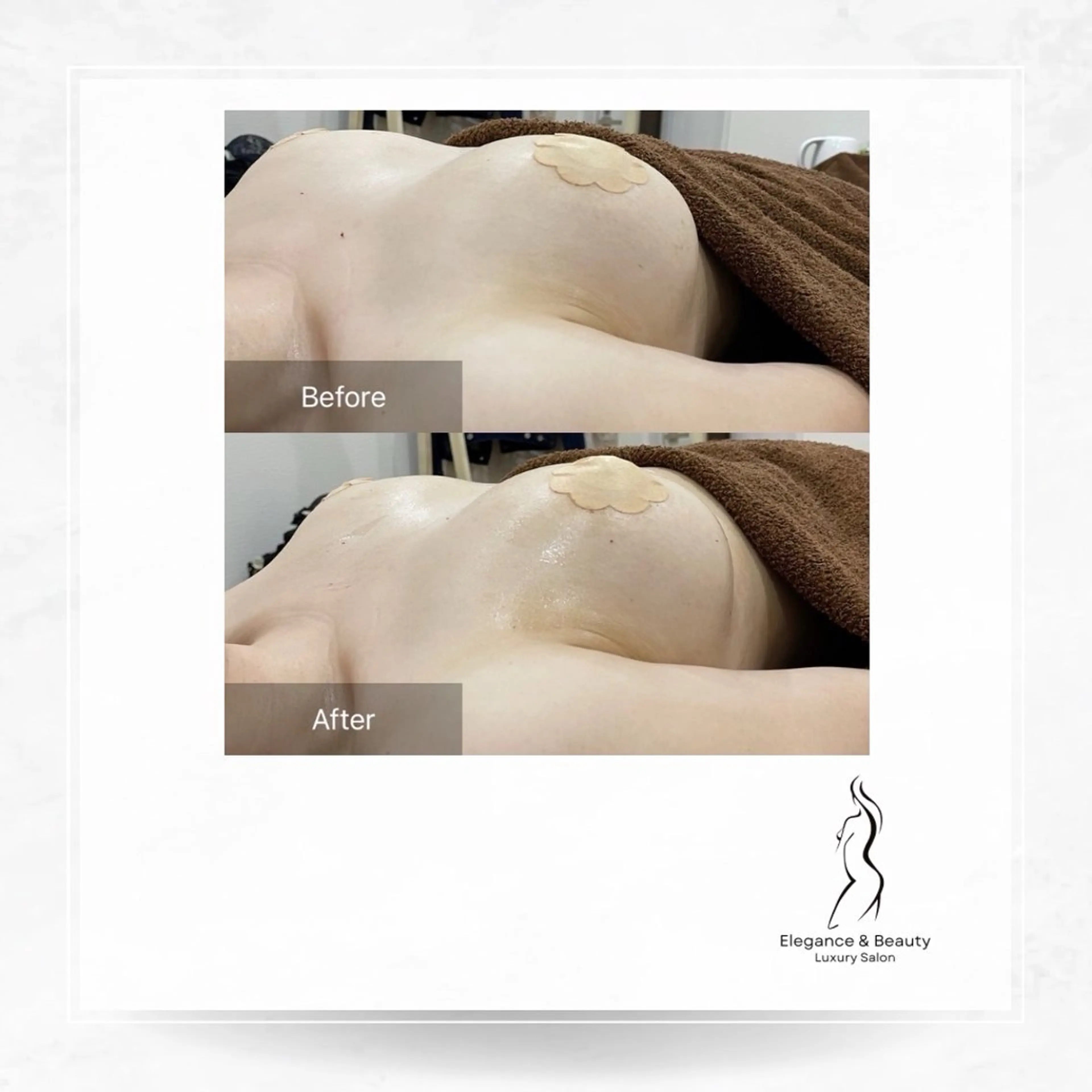 エステ Elegance&Beauty バストアップ専門店所属・Elegance &Beauty 船橋のエステ・リラクイメージ