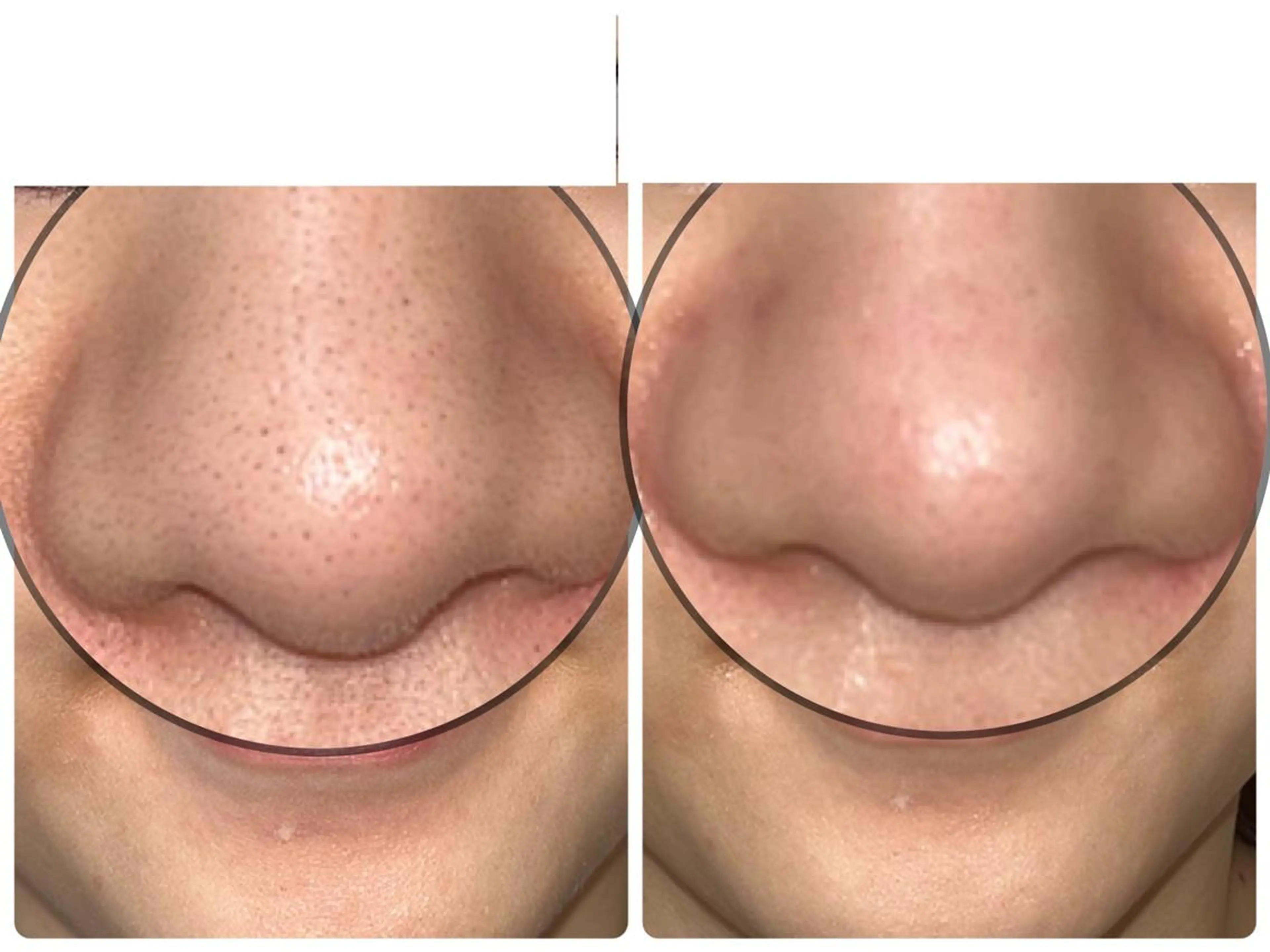 LILISHA 赤坂のエステ・リラクイメージ