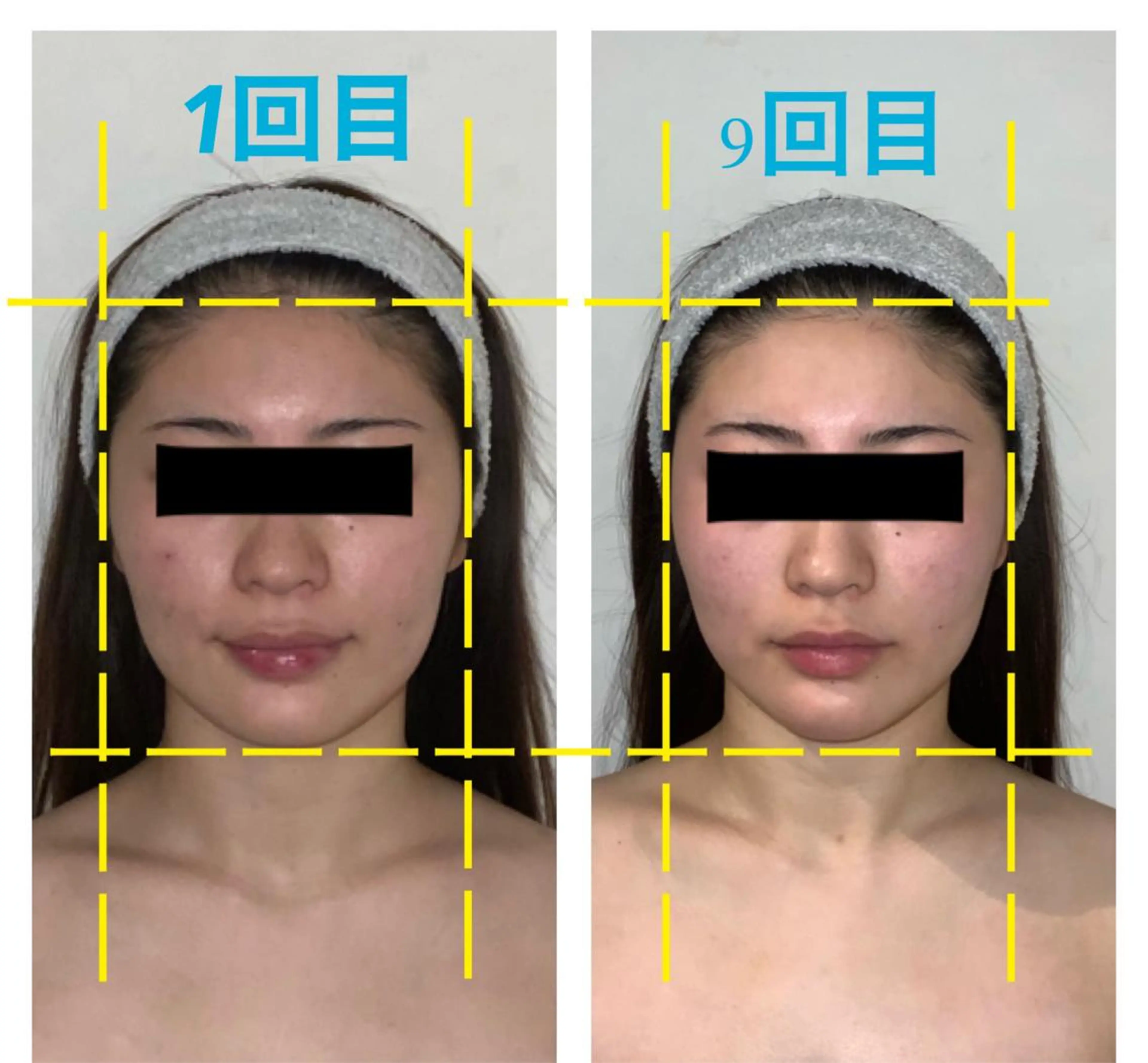 小顔プランナー辰巳 愛美のエステ・リラクイメージ