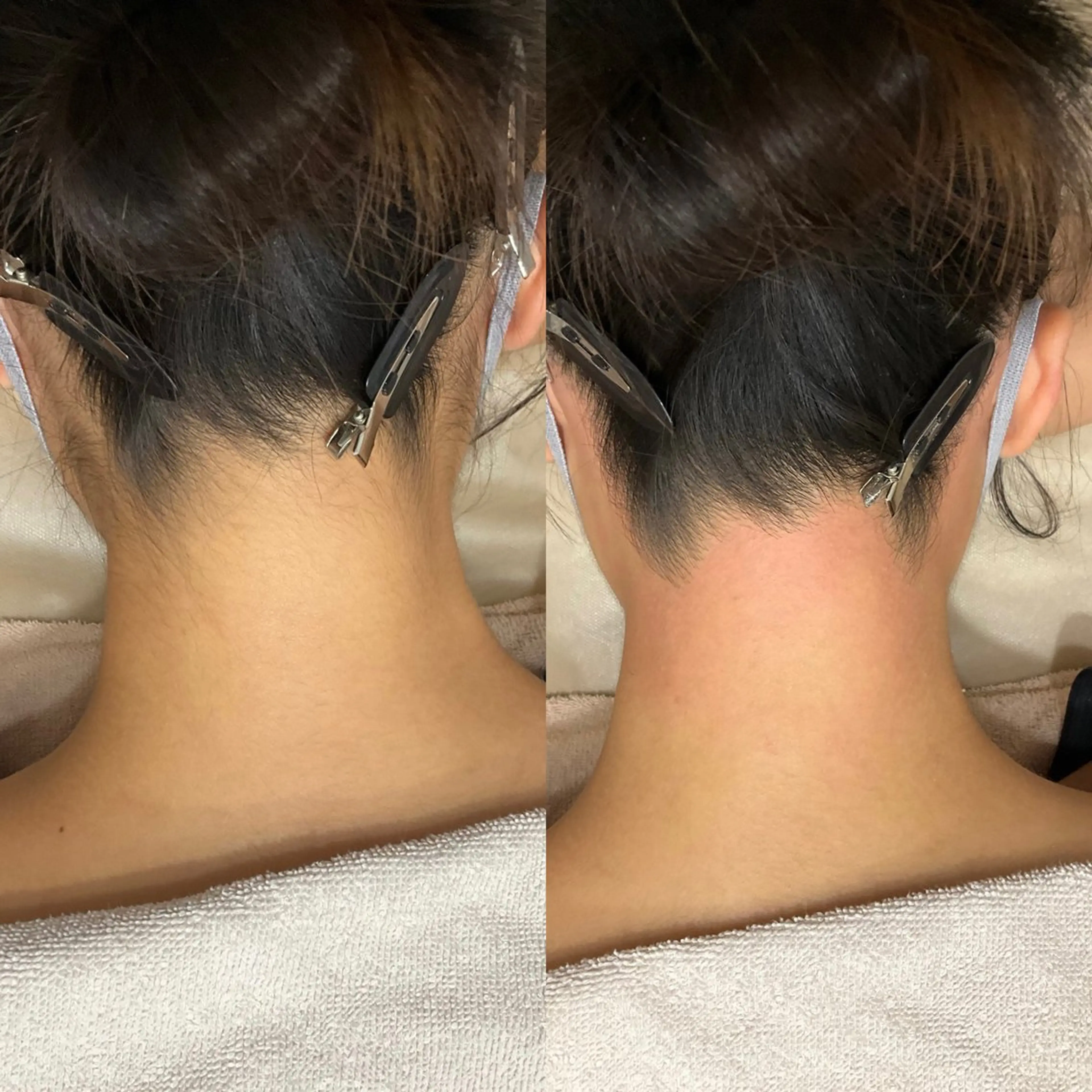 脱毛サロンBloom所属・Nami シュガーリングサロンのエステ・リラクイメージ