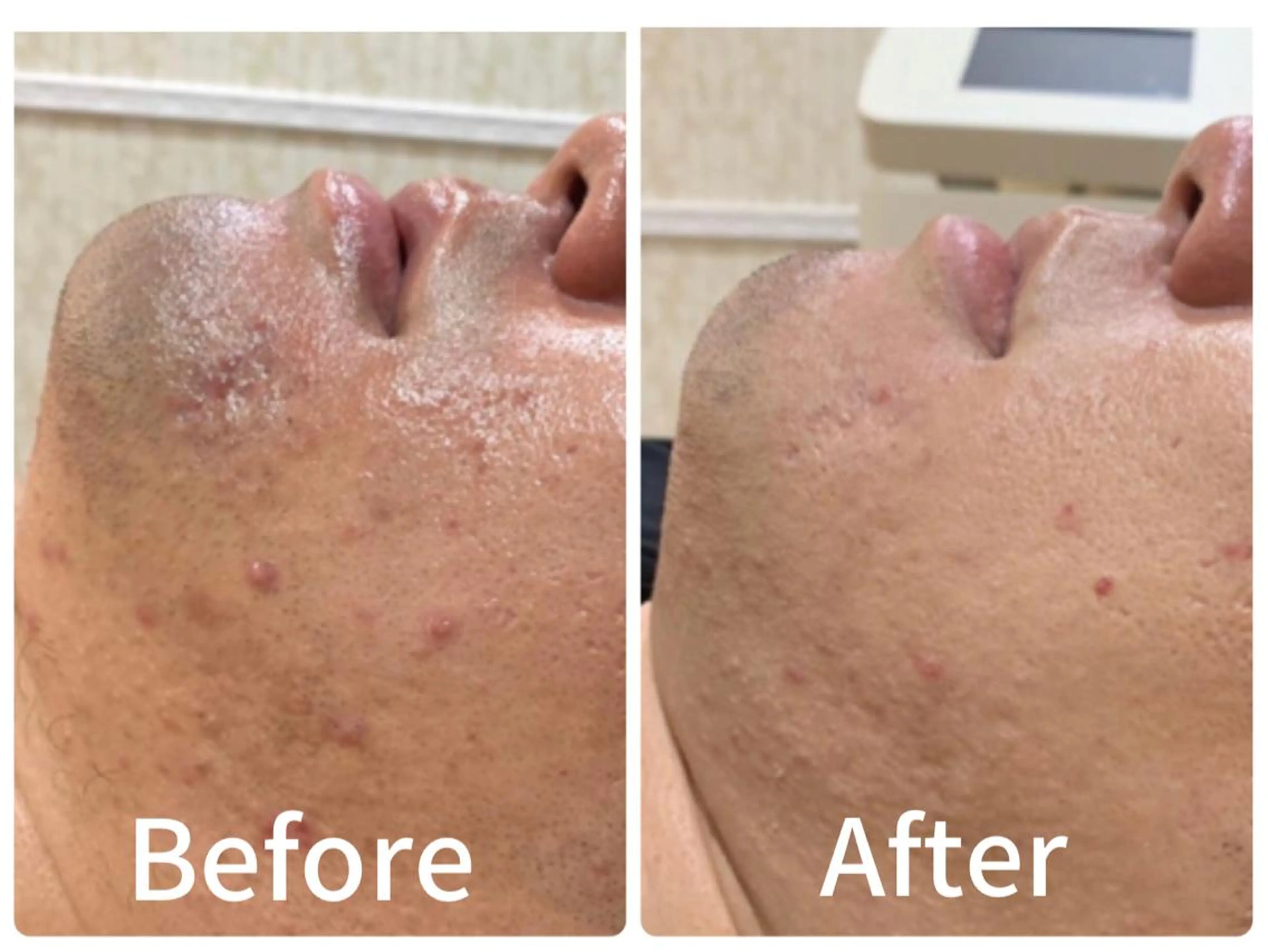 エステ 垣田 ジョアアンジェ京橋のエステ・リラクイメージ