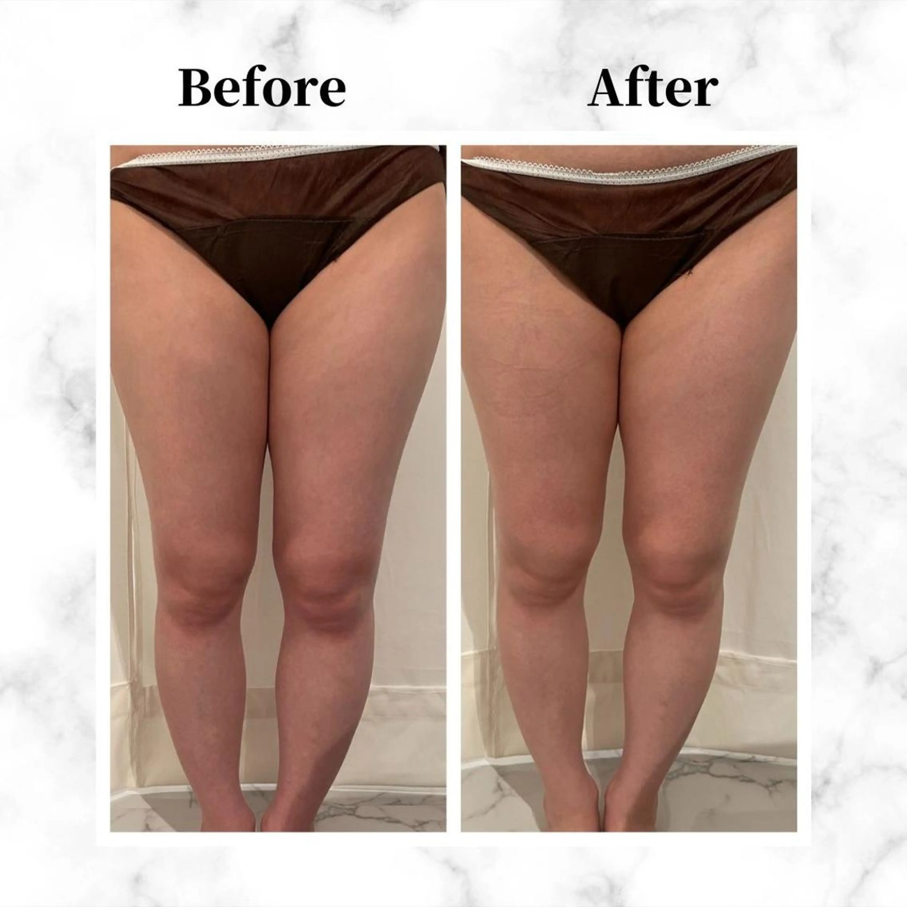 エステ リラク 12Dハイフ💗 最強小顔のエステ・リラクイメージ