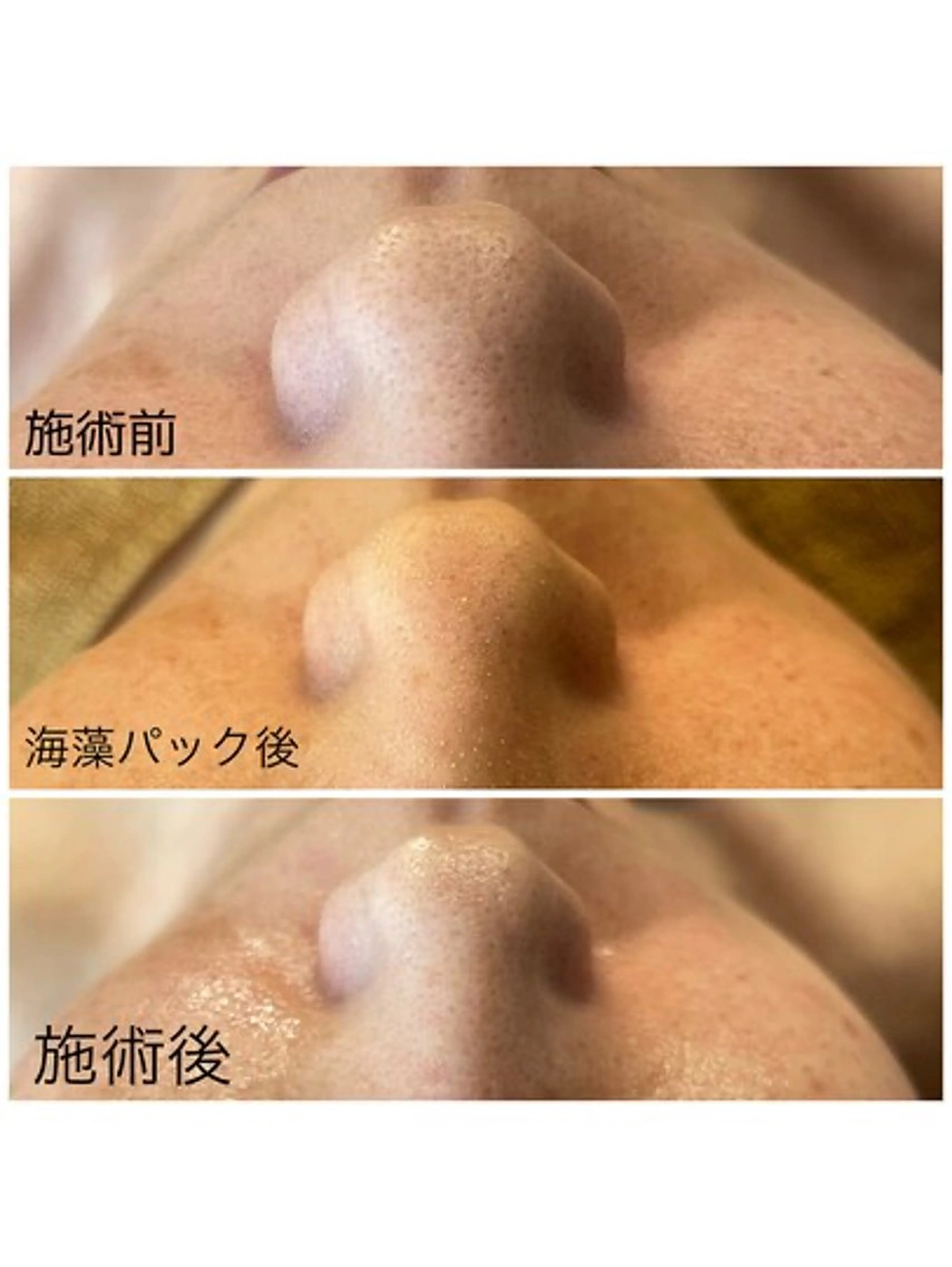 エステ 🌼SALON Lazuli久留米のエステ・リラクイメージ